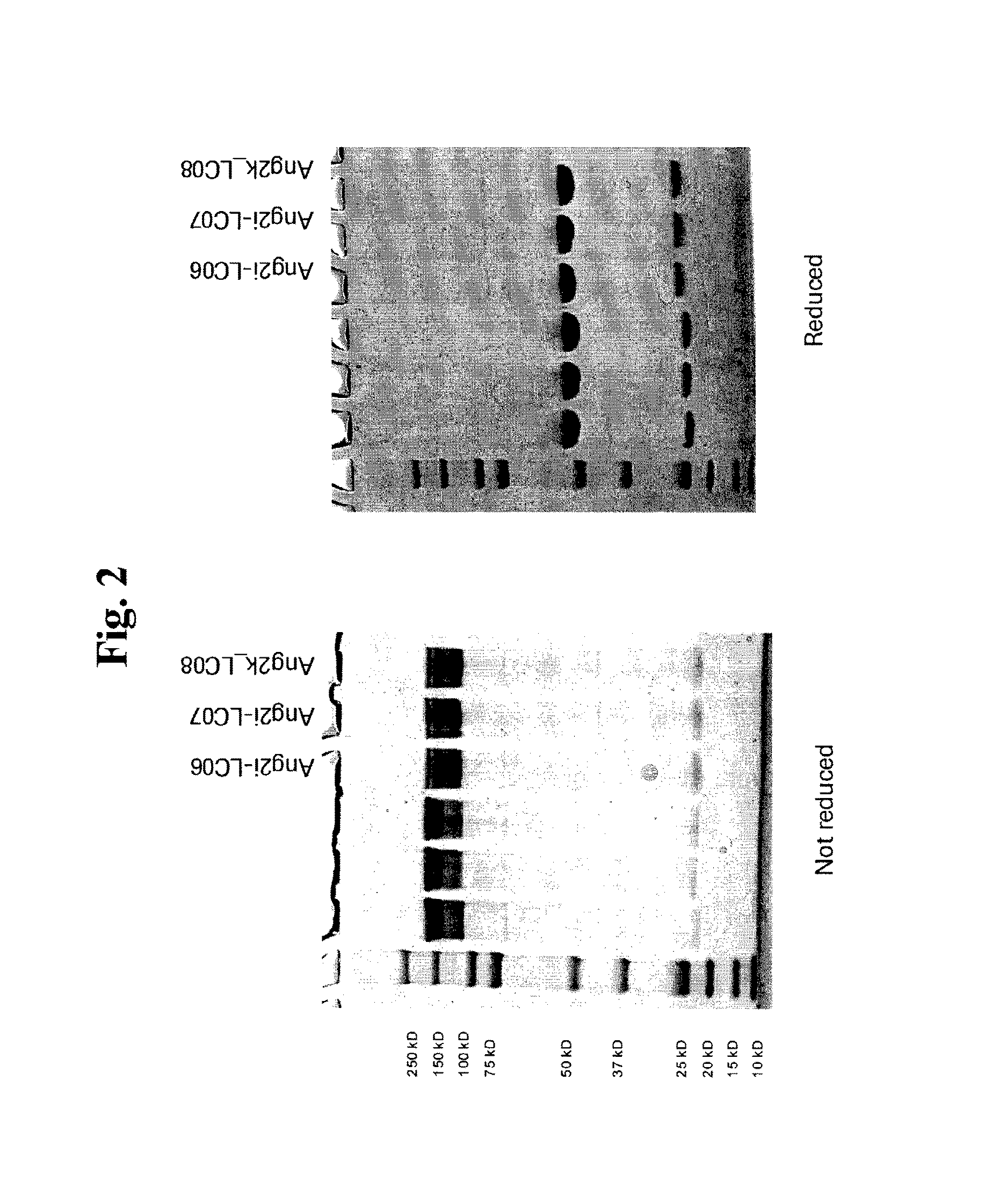 Antibodies against human angiopoietin 2