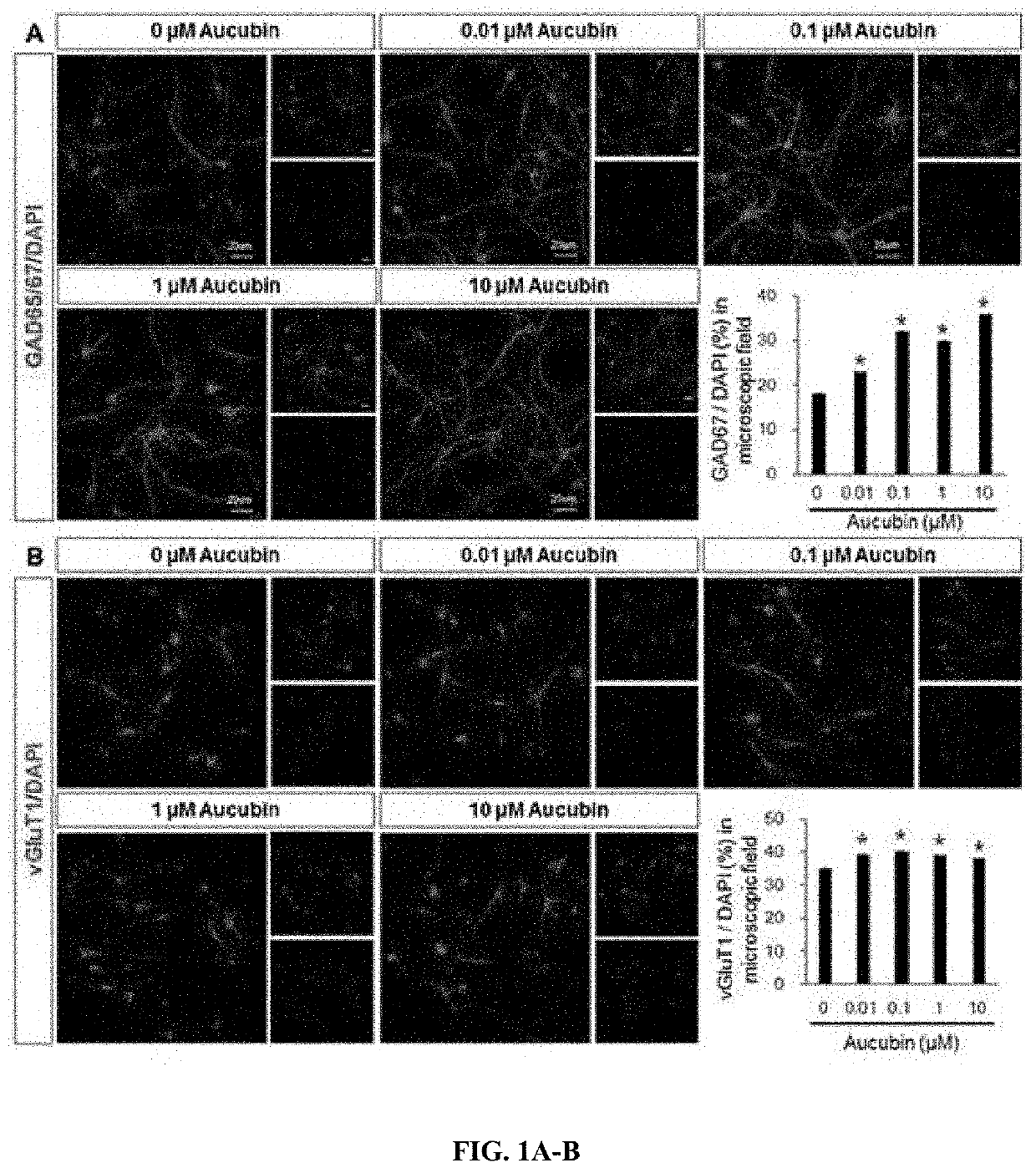 Composition for preventing or treating neurological disorder comprising aucubin