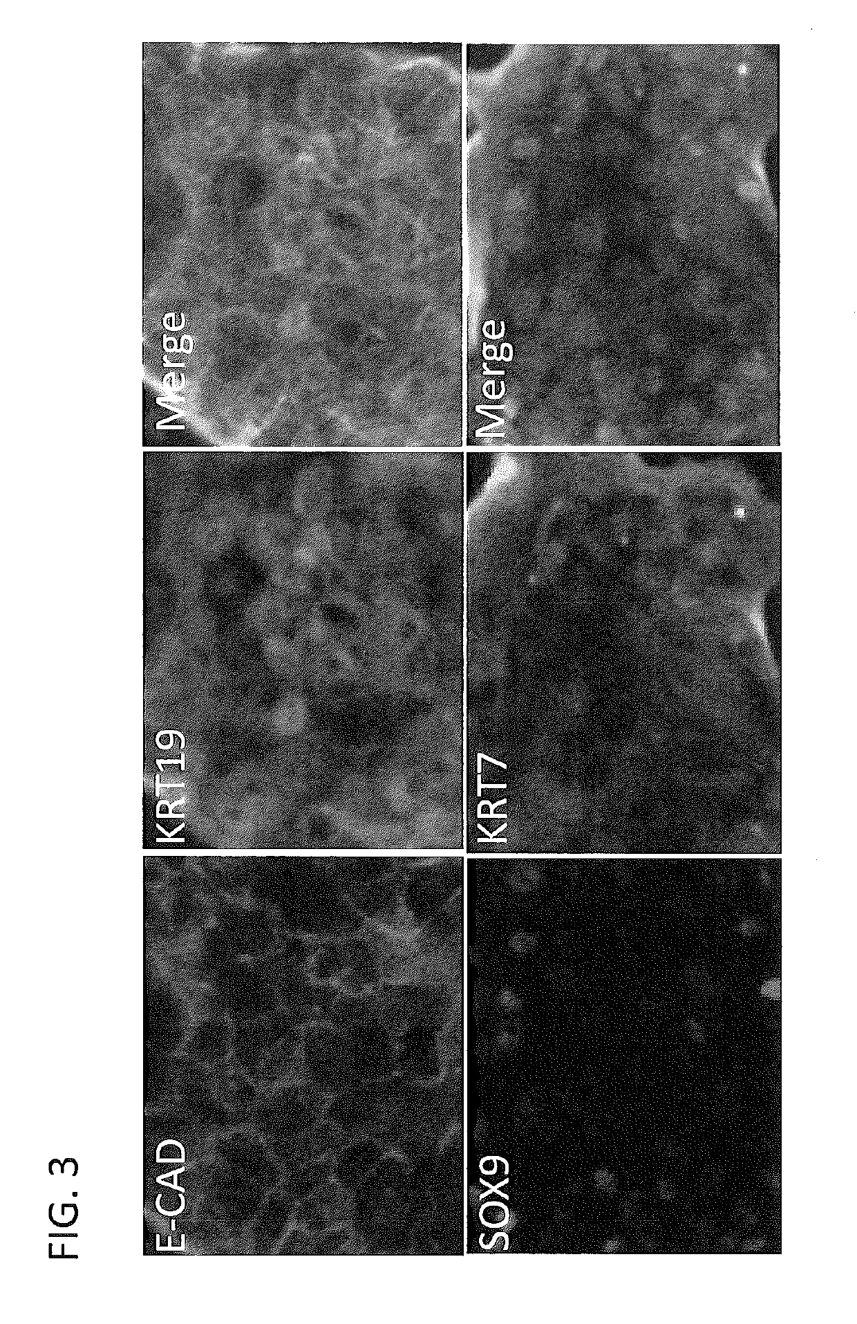 Derivation of hepatic stem cells and mature liver cell types and uses thereof