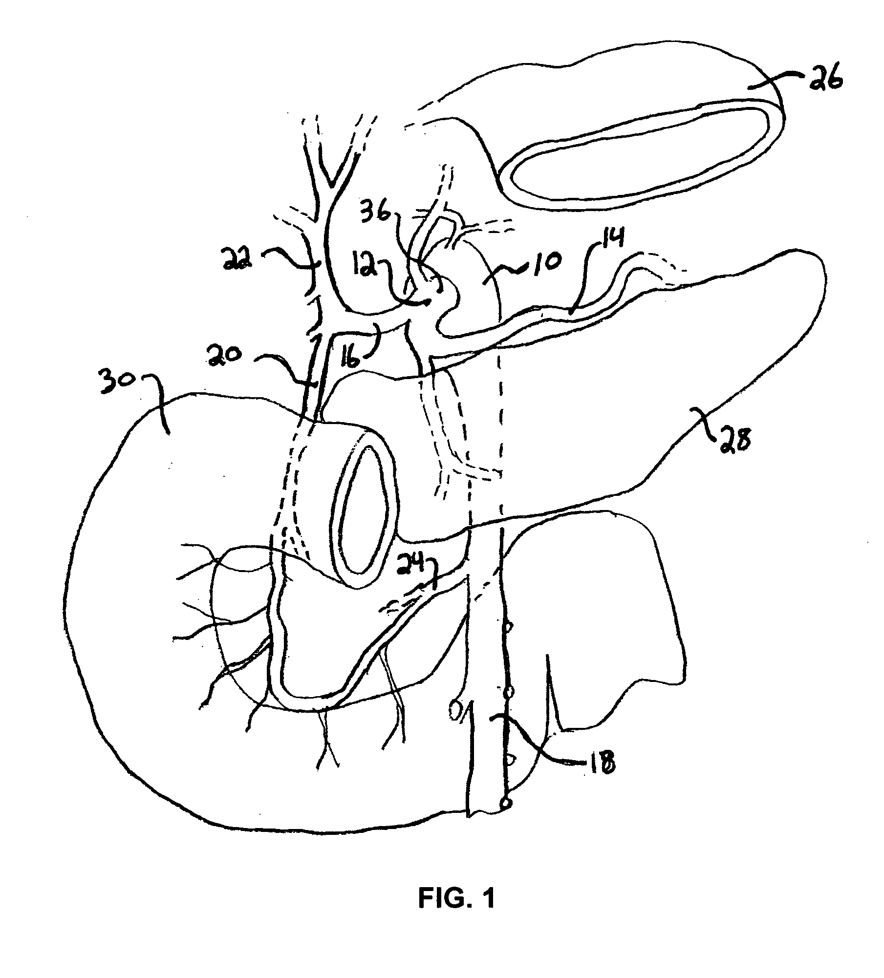 Systems and methods for treating obesity