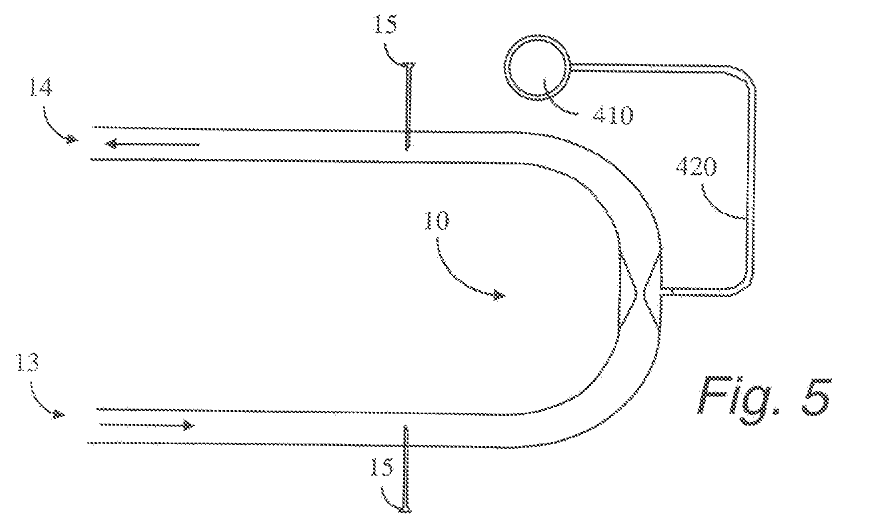 A-V dialysis graft