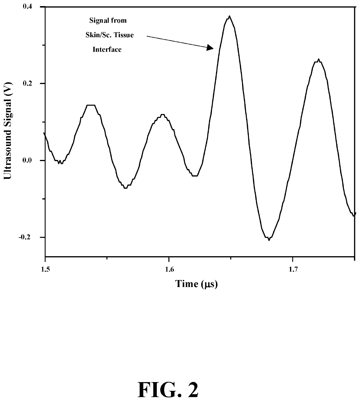 Wearable, noninvasive glucose sensing methods and systems