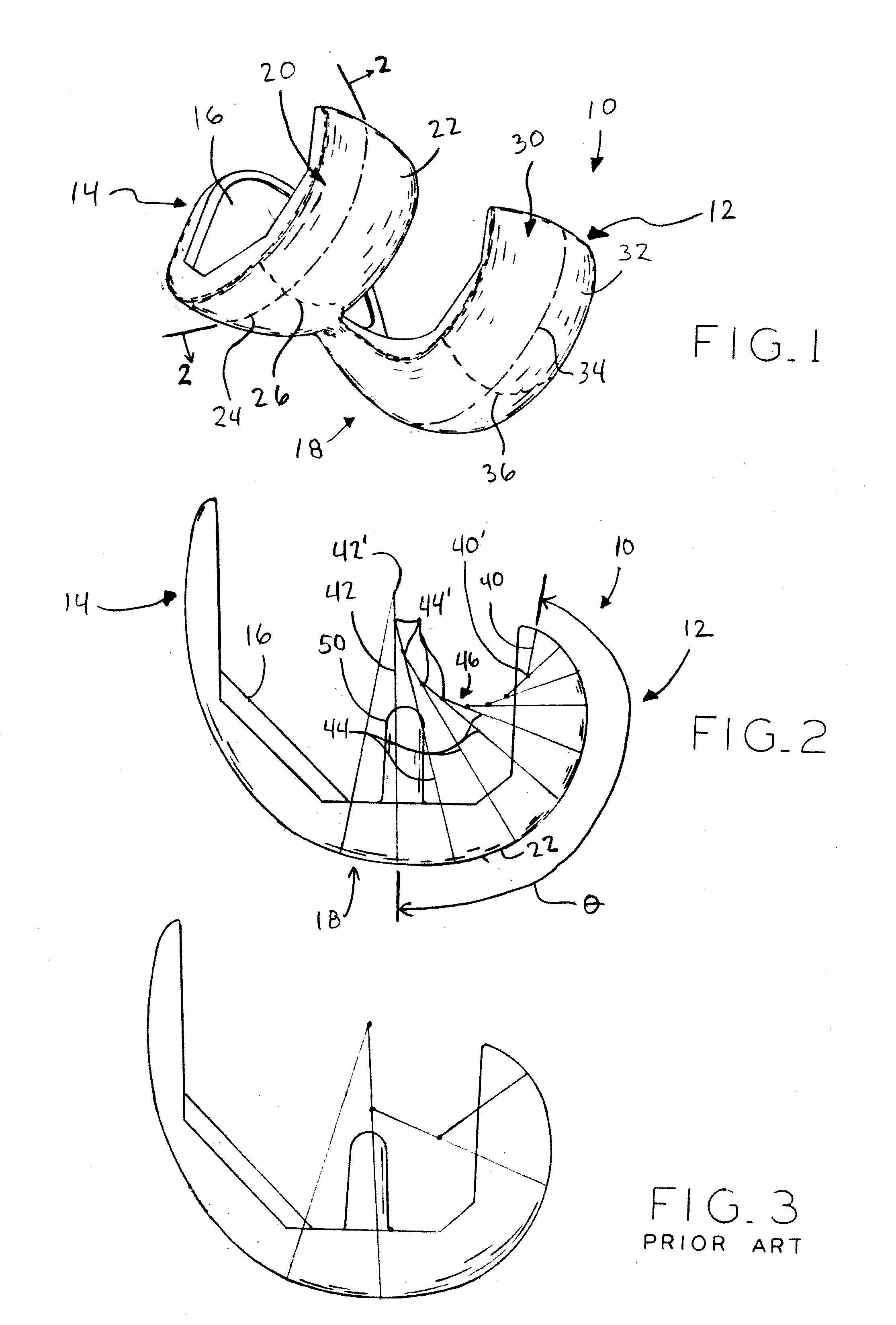 J-curve for a femoral prosthesis component