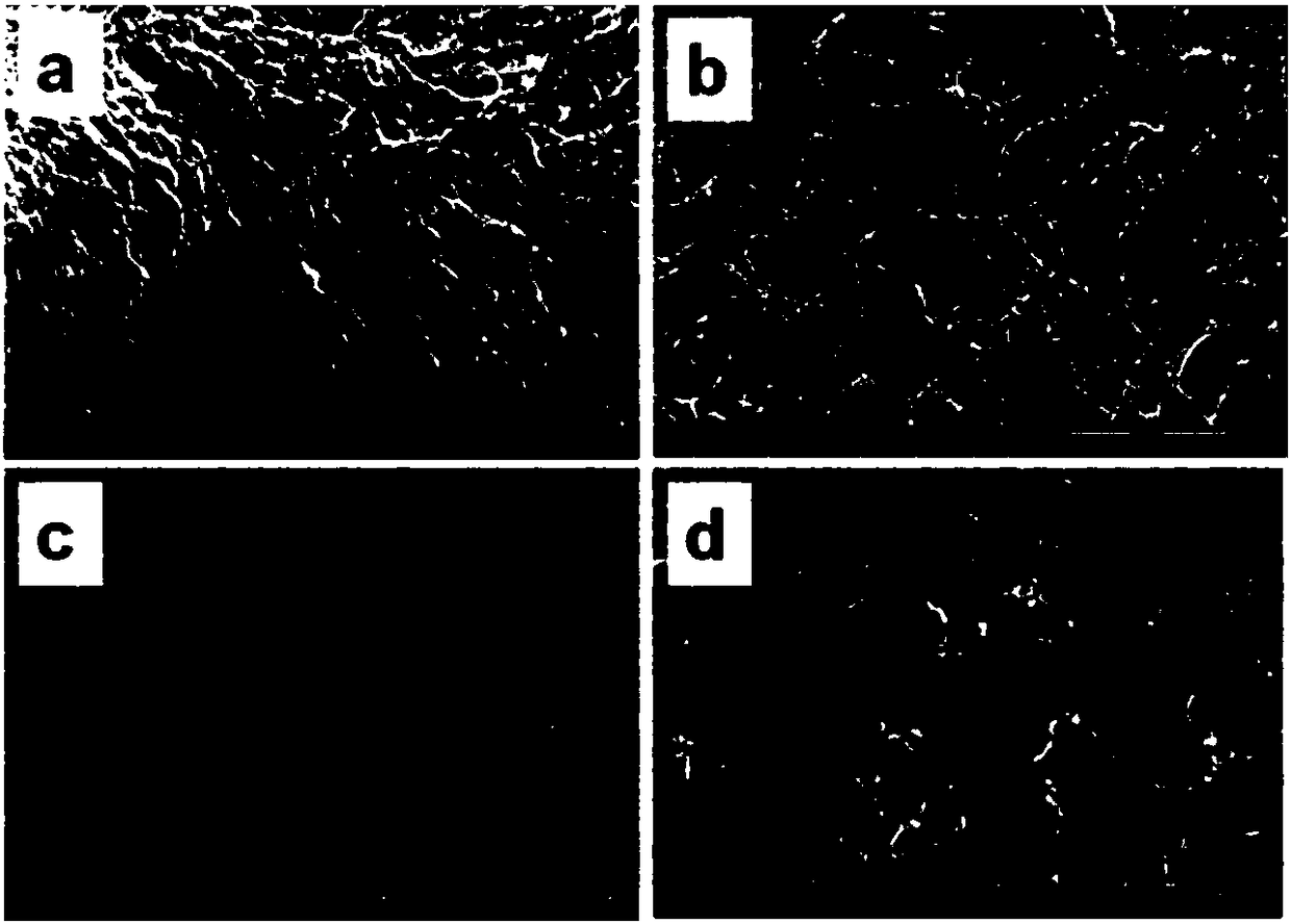 Method for preparing porous bacterial cellulose membrane