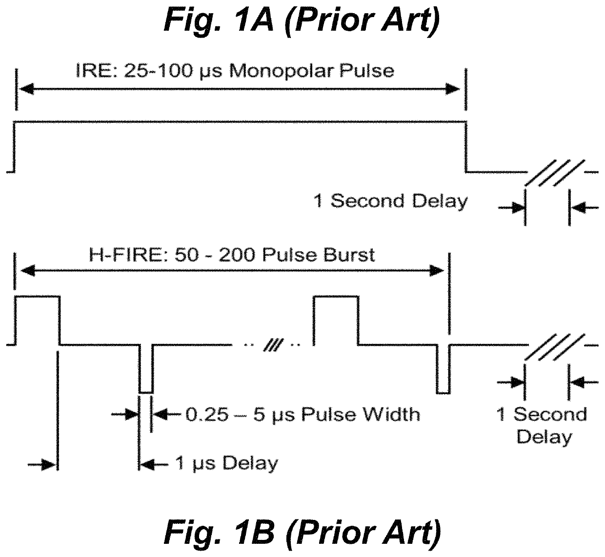 Methods for enhancing and modulating reversible and irreversible electroporation lesions by manipulating pulse waveforms