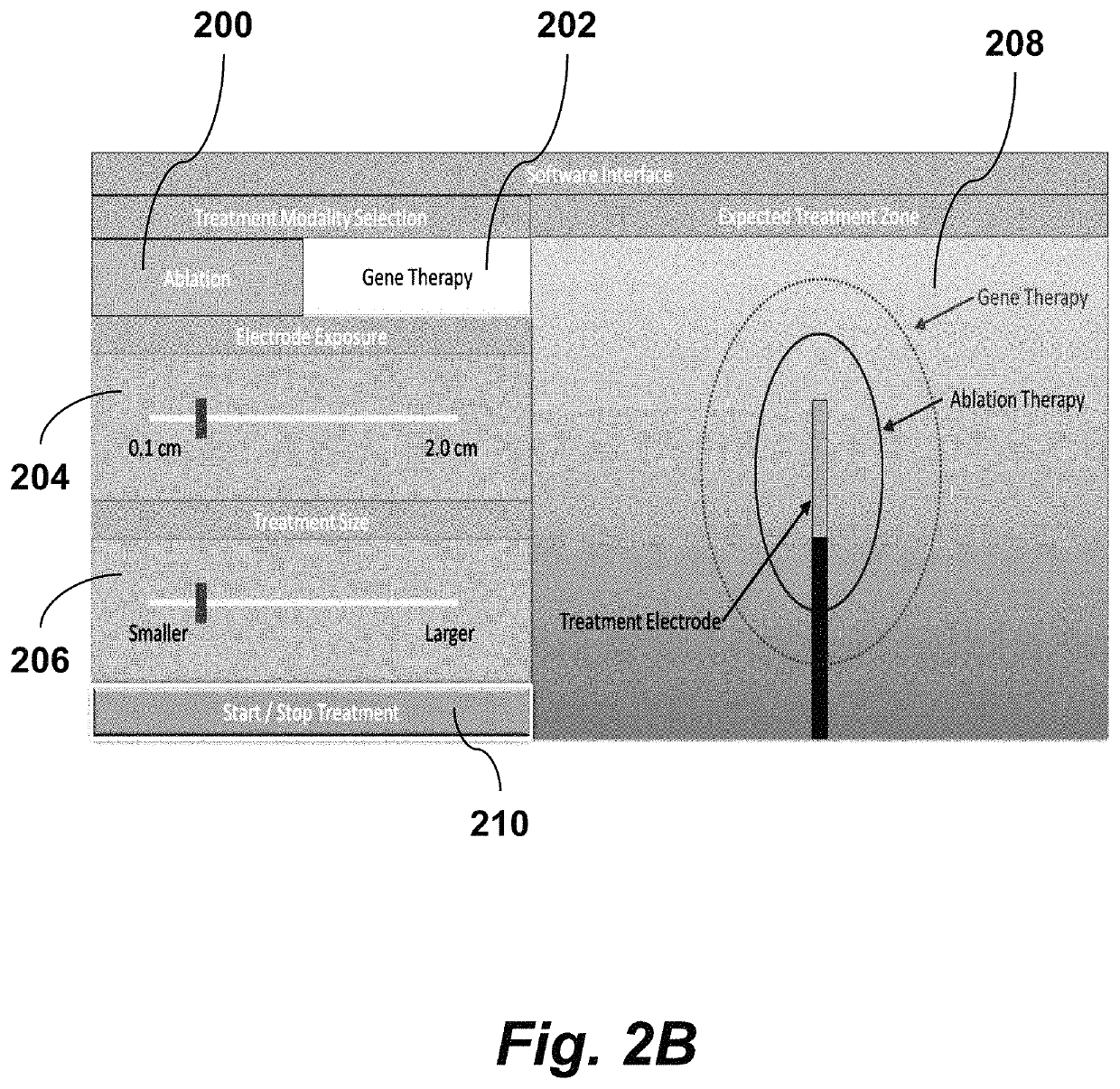 Methods for enhancing and modulating reversible and irreversible electroporation lesions by manipulating pulse waveforms