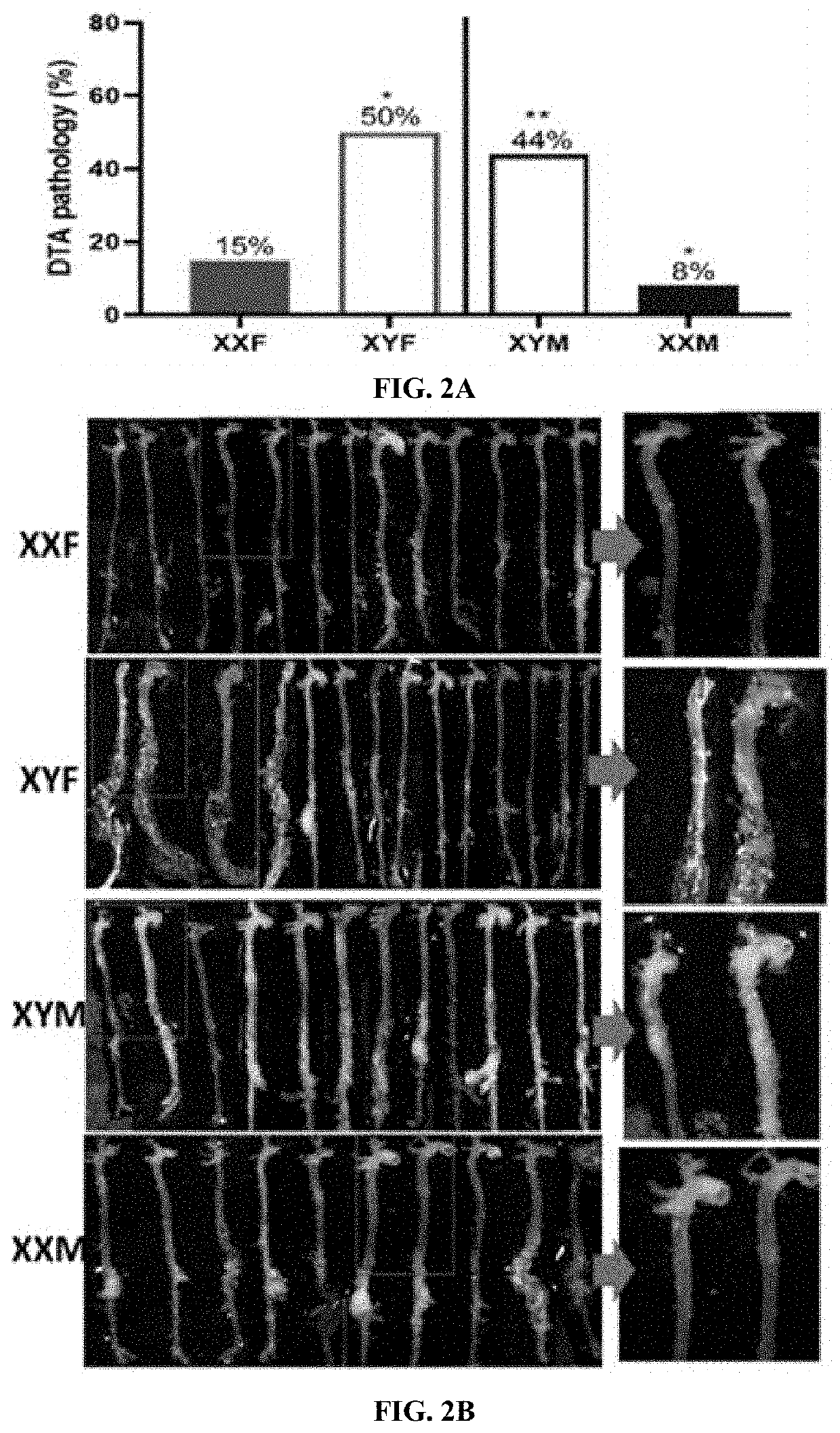 5HT3R Antagonist For Use in Treating Aneurysms and Cardiovascular Risk