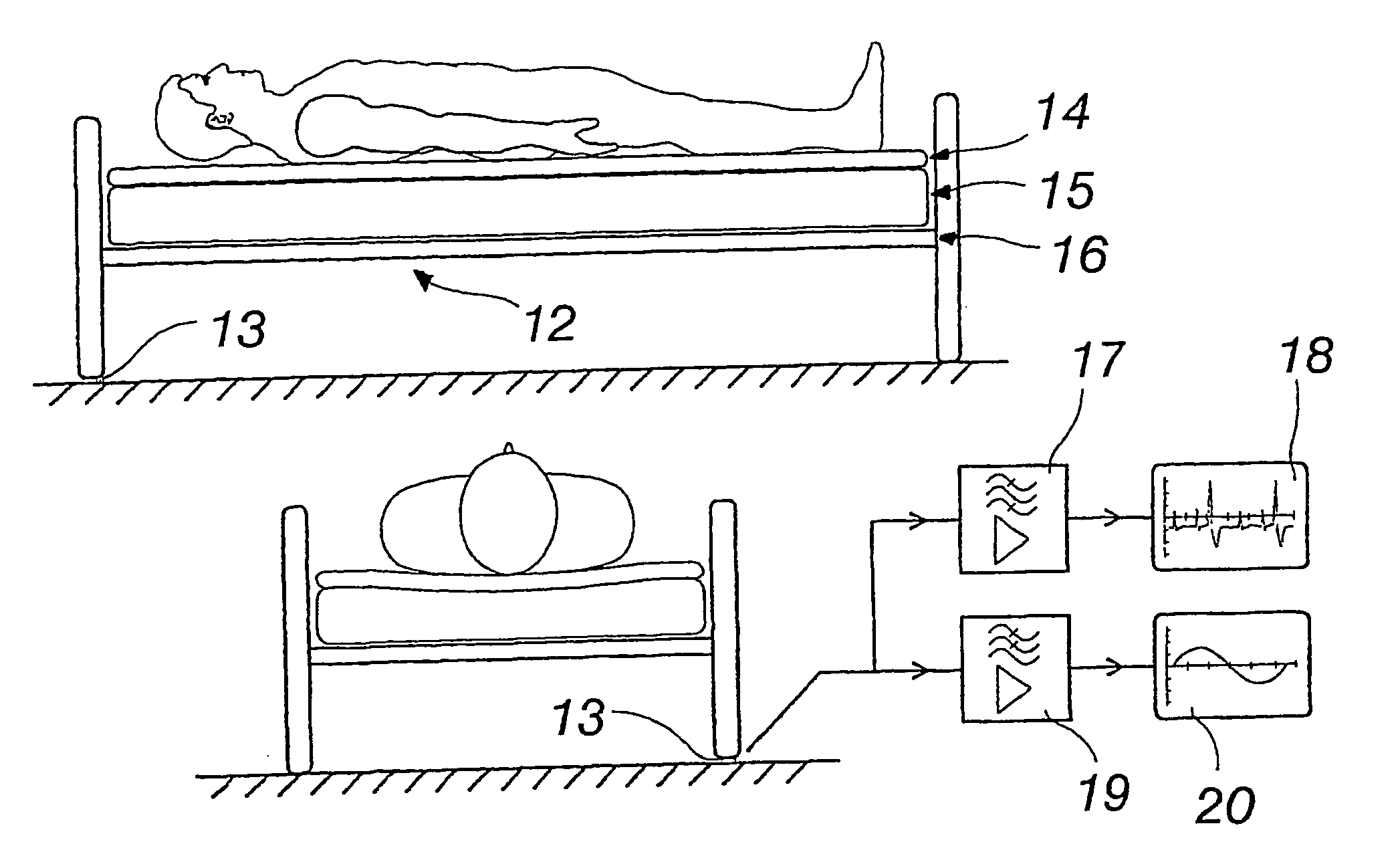 Force or pressure sensor and method for applying the same