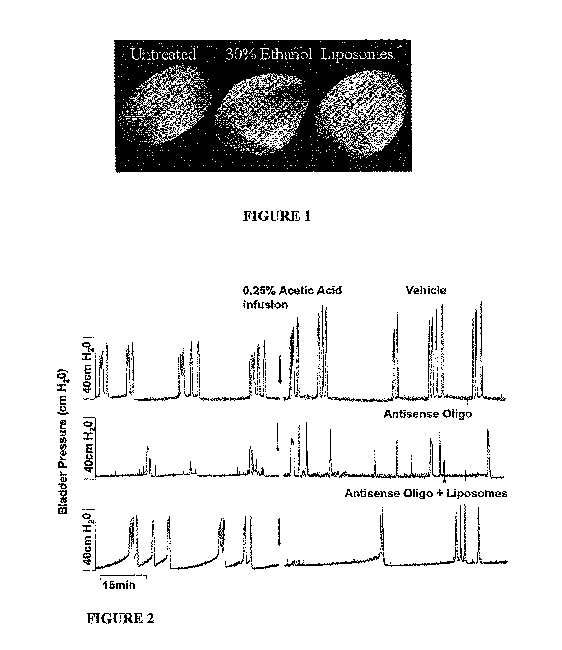 Instillation of liposomal formulation of sirna and antisense oligonucleotides