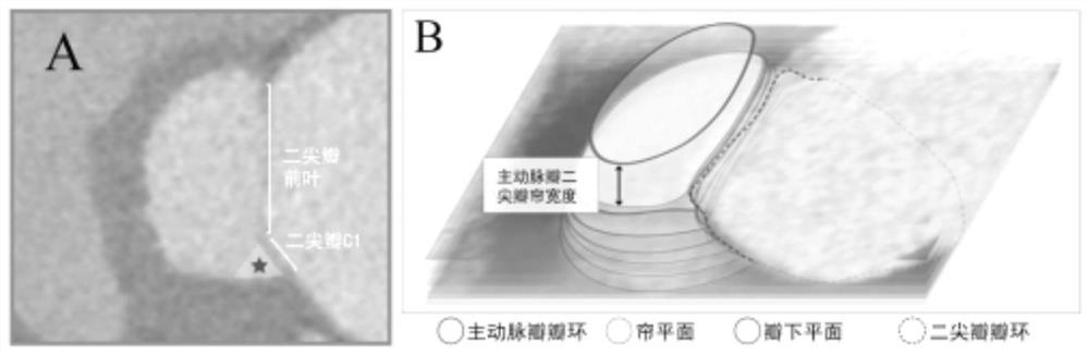 Transcatheter aortic valve replacement postoperative complication prediction method, device and equipment