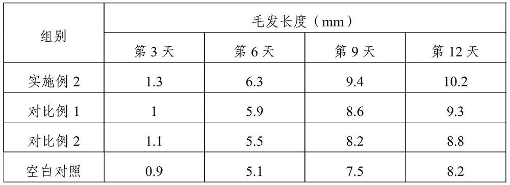 Composition for preventing hair loss and nourishing scalp as well as preparation method and application of composition