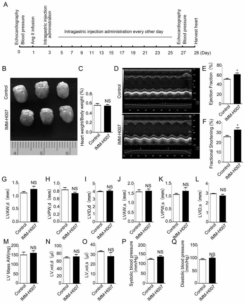 Application of triacetyl-3-hydroxyphenyladenosine in preparation of medicine for inhibiting cardiac fibrosis