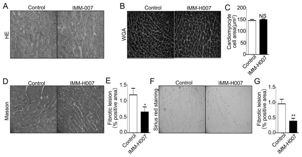 Application of triacetyl-3-hydroxyphenyladenosine in preparation of medicine for inhibiting cardiac fibrosis