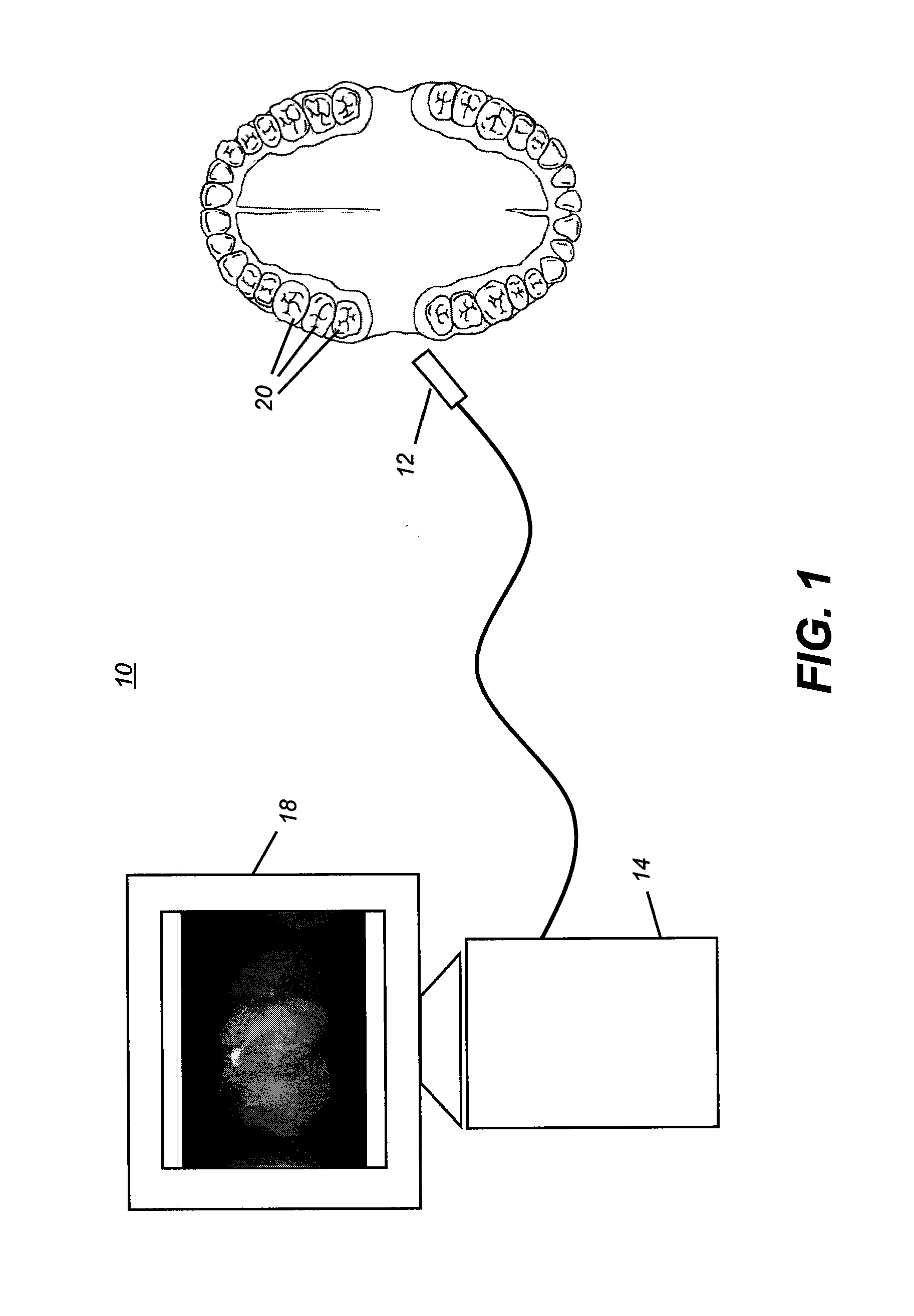 Method for real-time visualization of caries condition