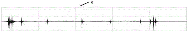 Circuit for automatically identifying and analyzing insulin pen injection sound