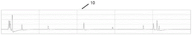 Circuit for automatically identifying and analyzing insulin pen injection sound