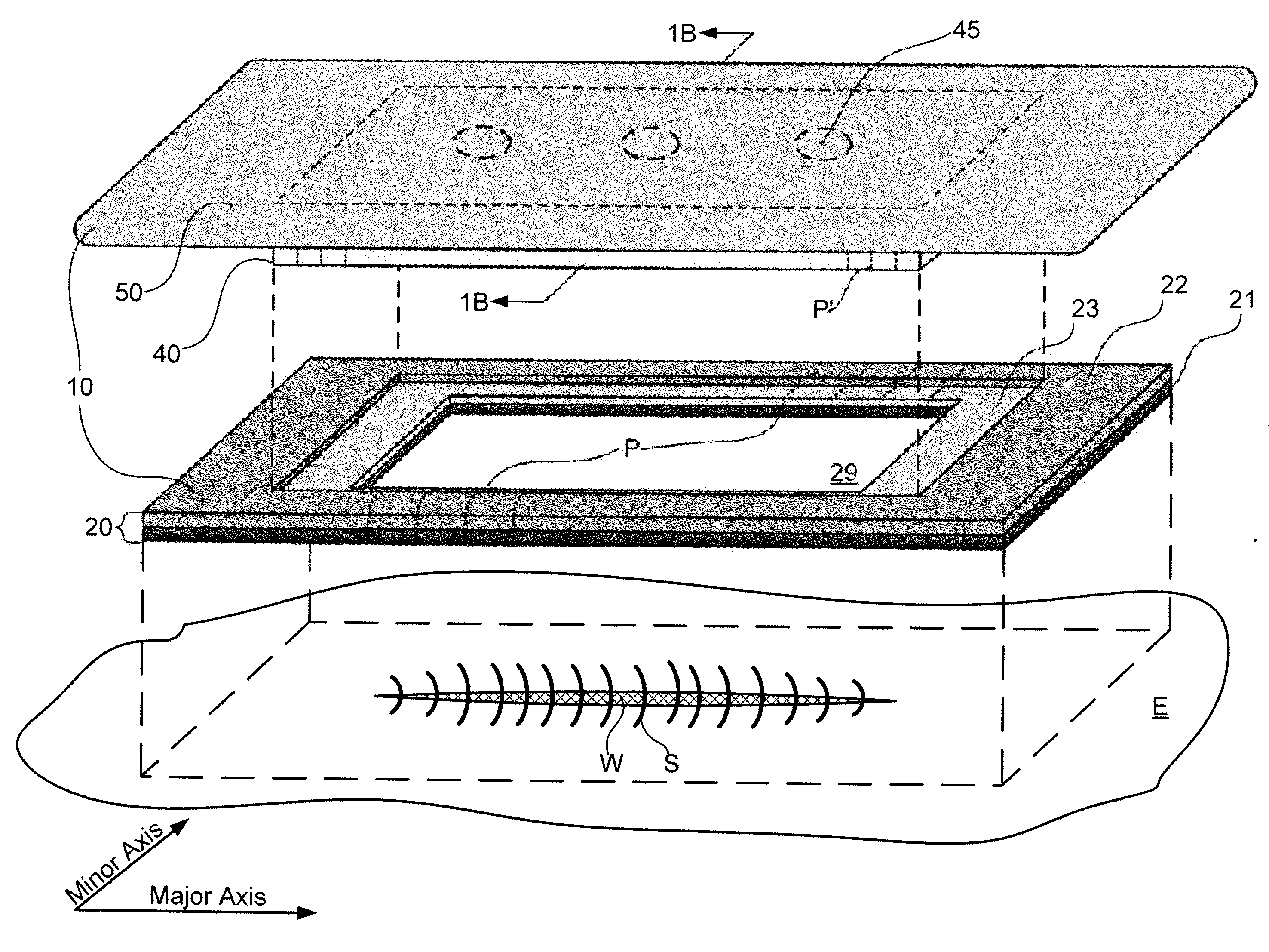 Systems And Methods For Protecting Incisions