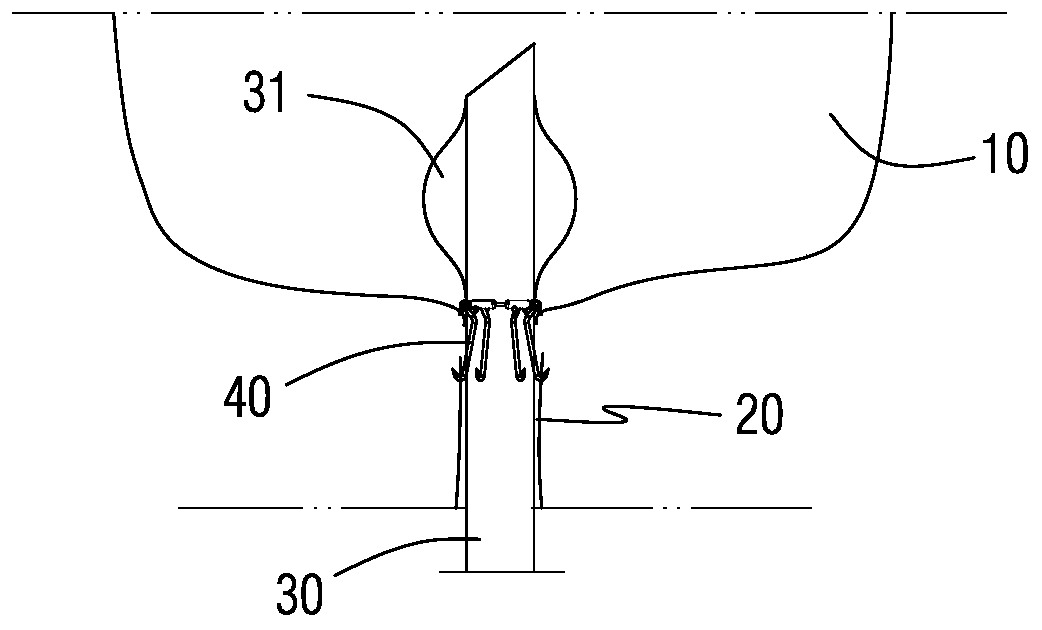 A collapsible bladder-urethral stapler