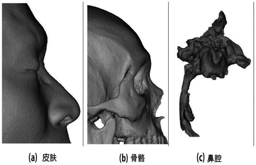 Nose implant manufacturing method