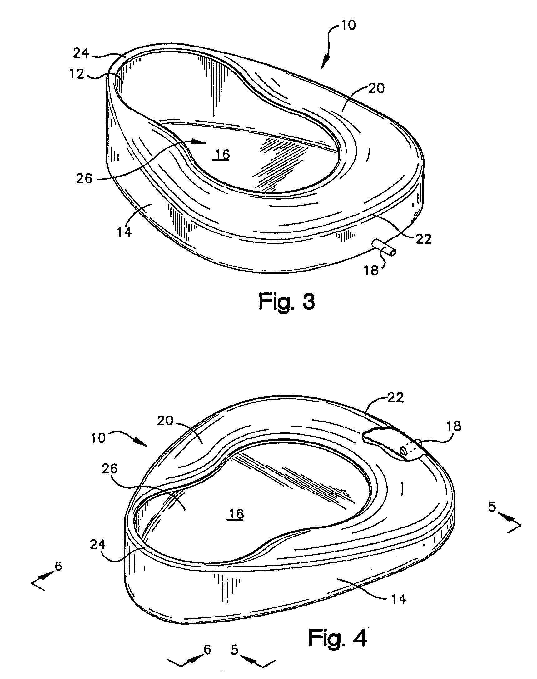 Bedpan and method for removal of the contents thereof