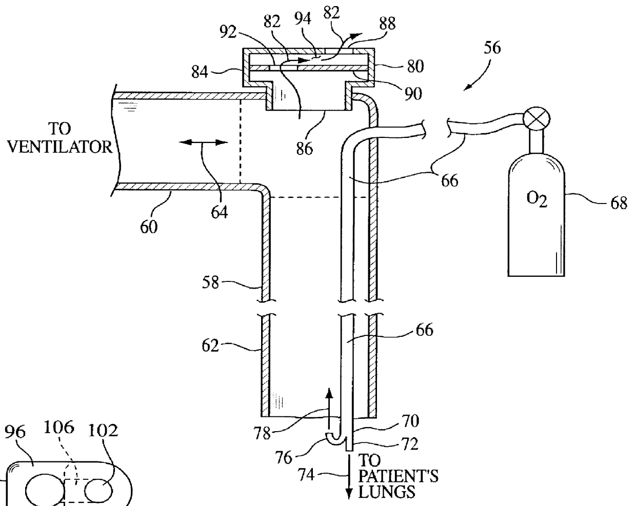 Insufflation system, attachment and method