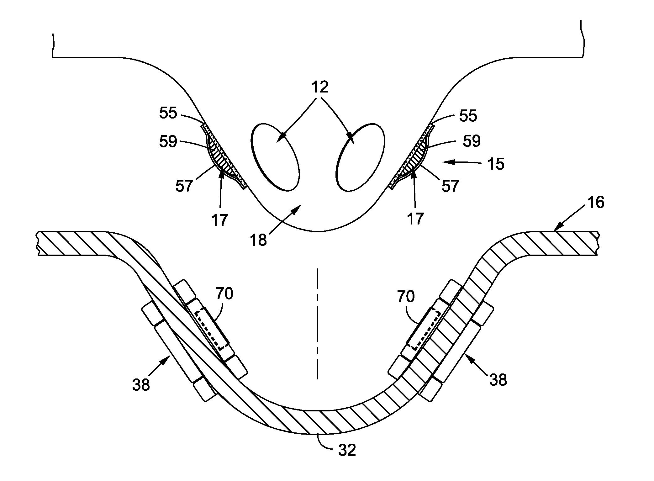 Goggle breathing system