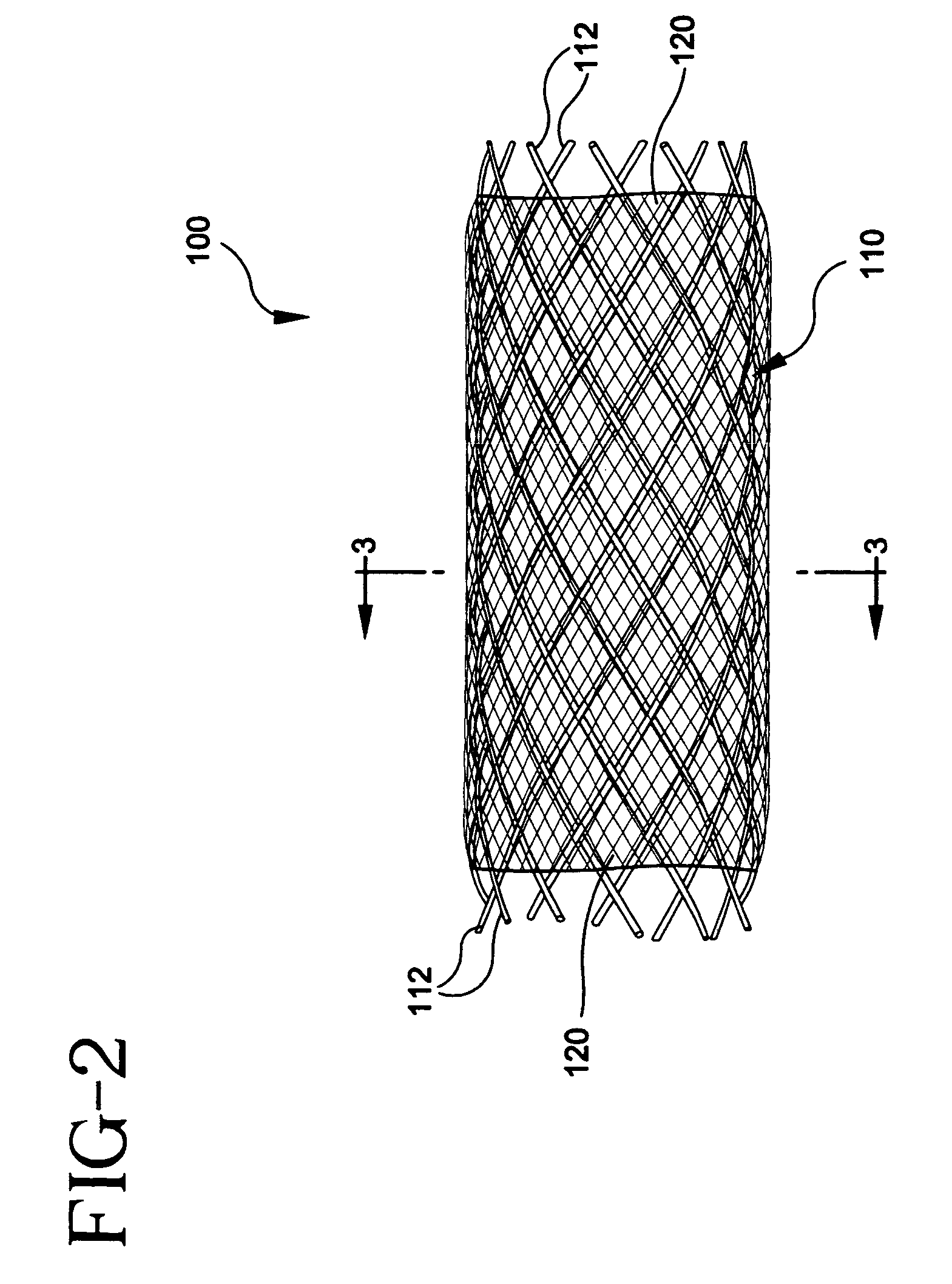 Stent-graft with bioabsorbable structural support