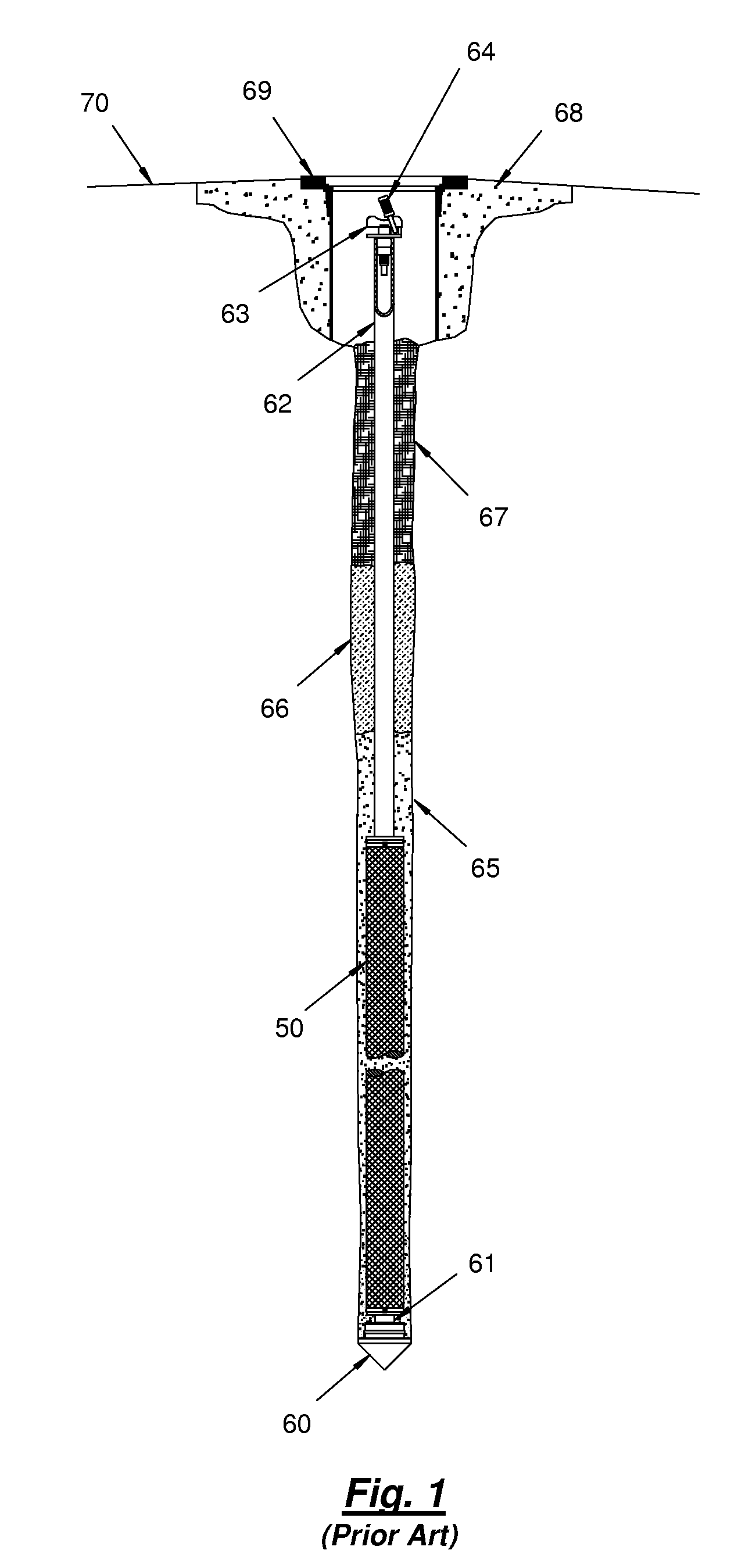 Snap-lock bushing for prepacked screens