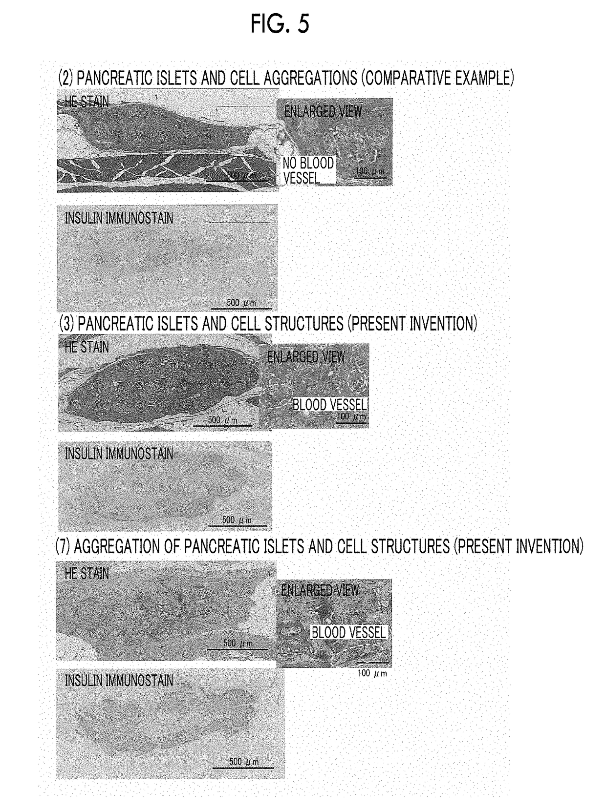 Composition, cell structure, pancreatic islet transplantation kit, pancreatic islet cell transplantation treatment agent and hypoglycemic agent, composition containing pancreatic islet, kit containing pancreatic islet, and pancreatic islet transplantation treatment agent and hypoglycemic agent