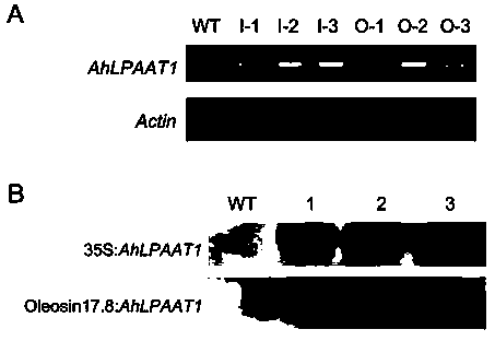 Peanut lysophosphatidic acid acyltransferase gene and application thereof