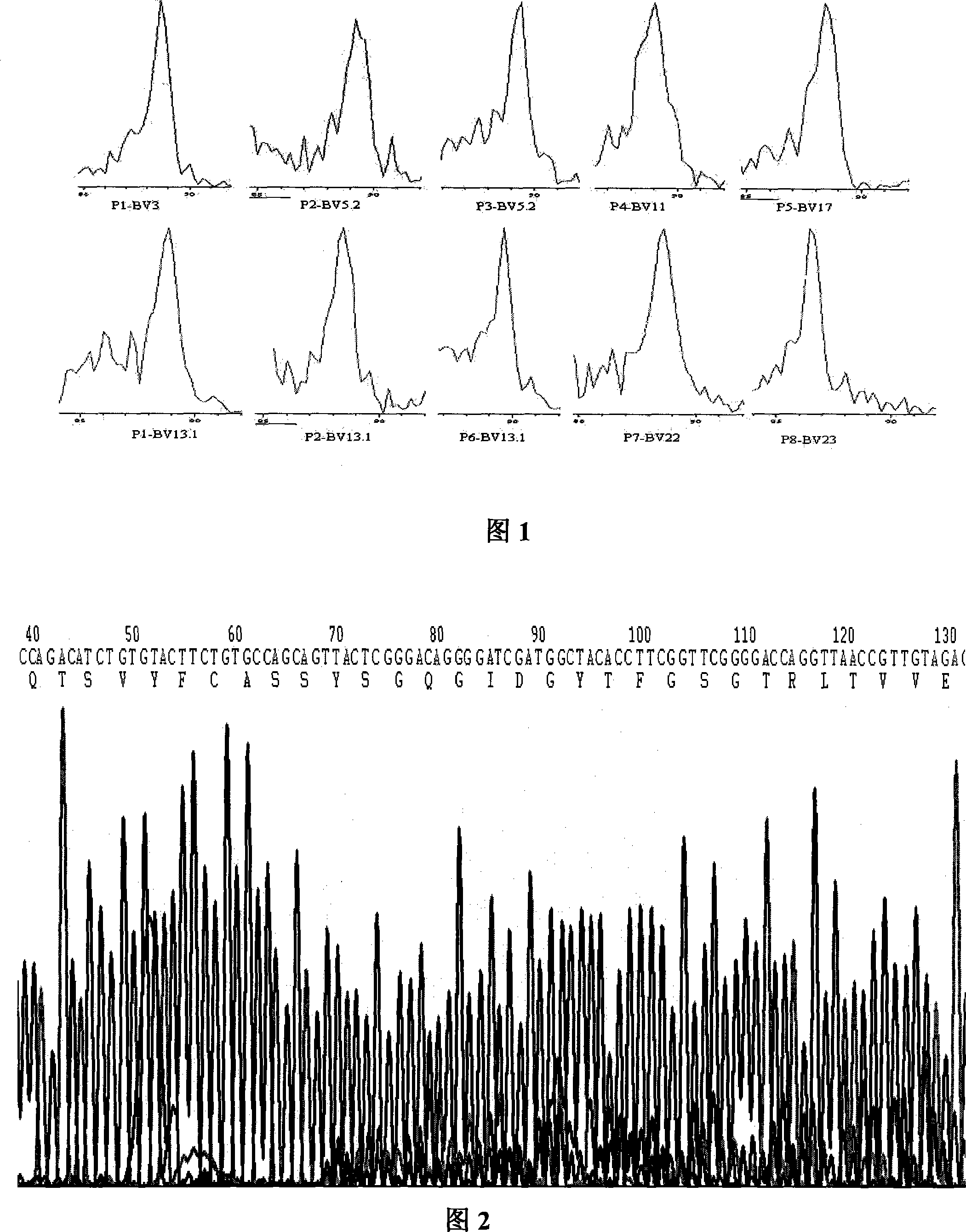 Method for detecting genetic constitution of clone-specific T lymphocyte TCR BV CDR3