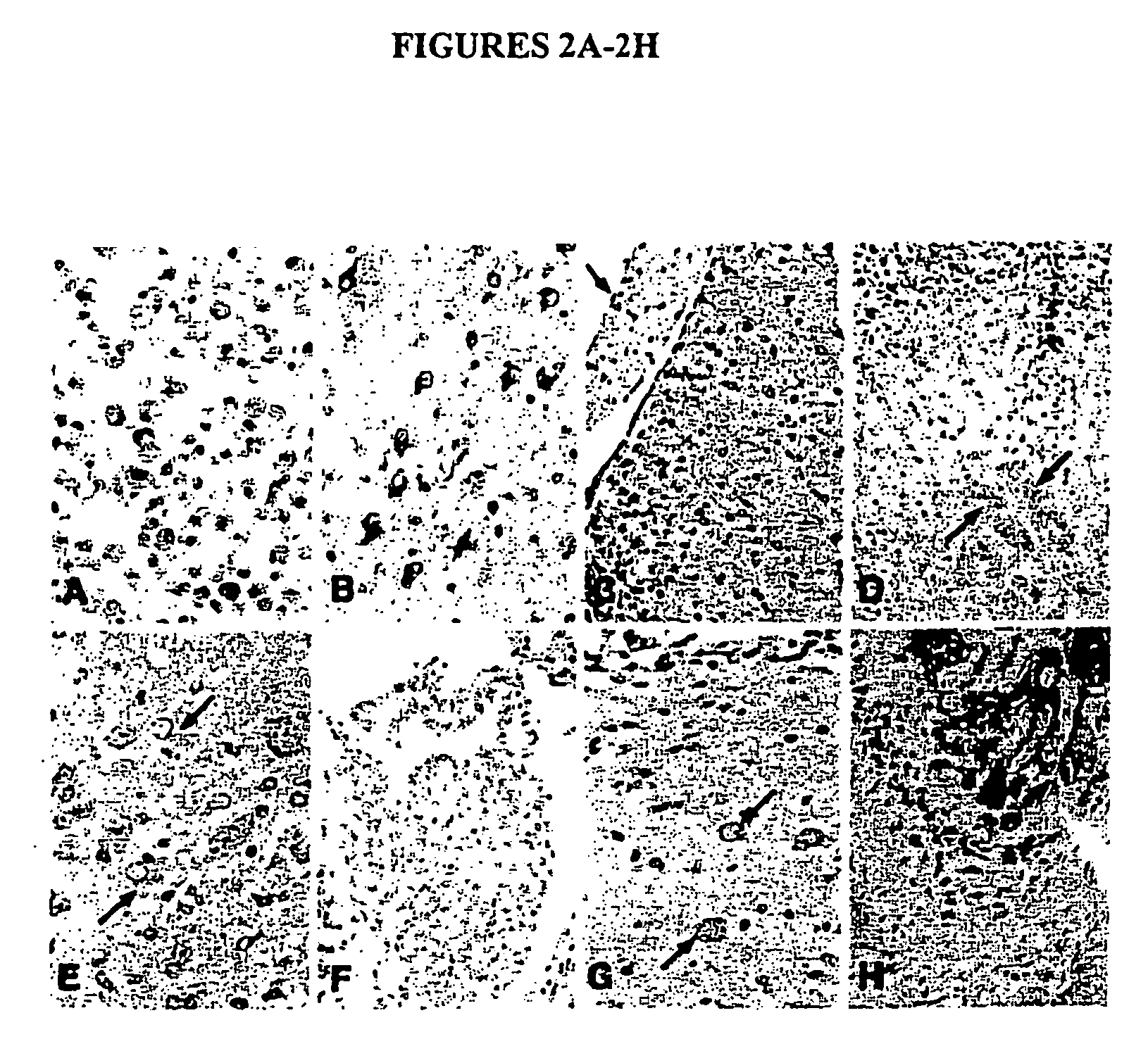 Osteopontin-related compositions and methods