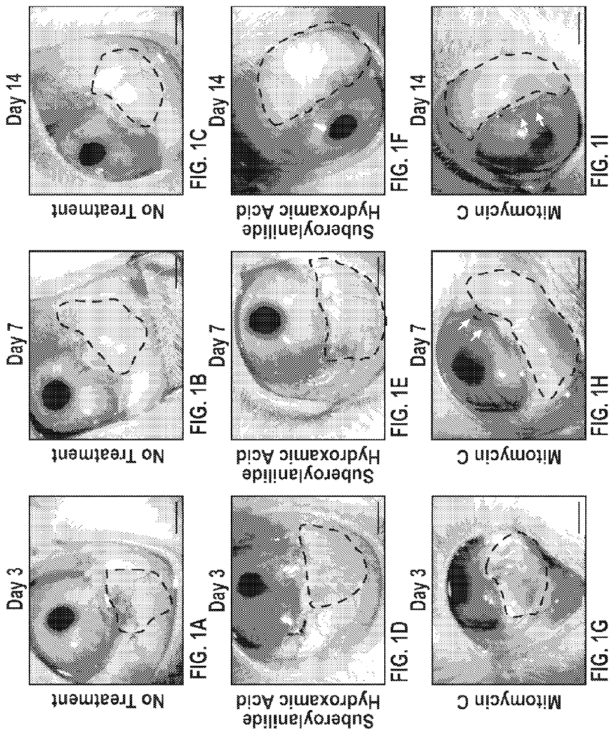 Methods and compositions for promoting wound healing with decreased scar formation after glaucoma filtration surgery