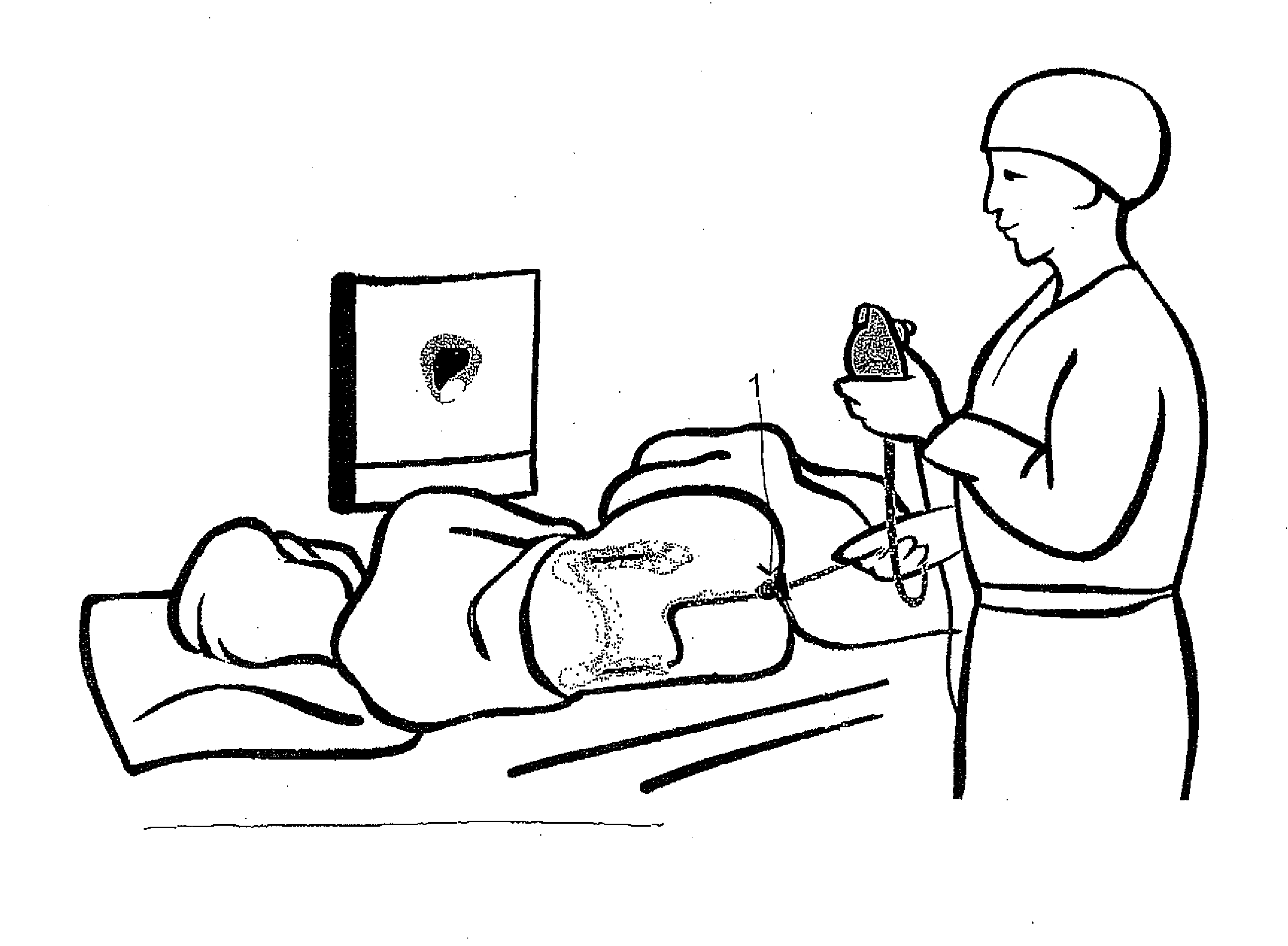 Enema and Coloscopy Aide