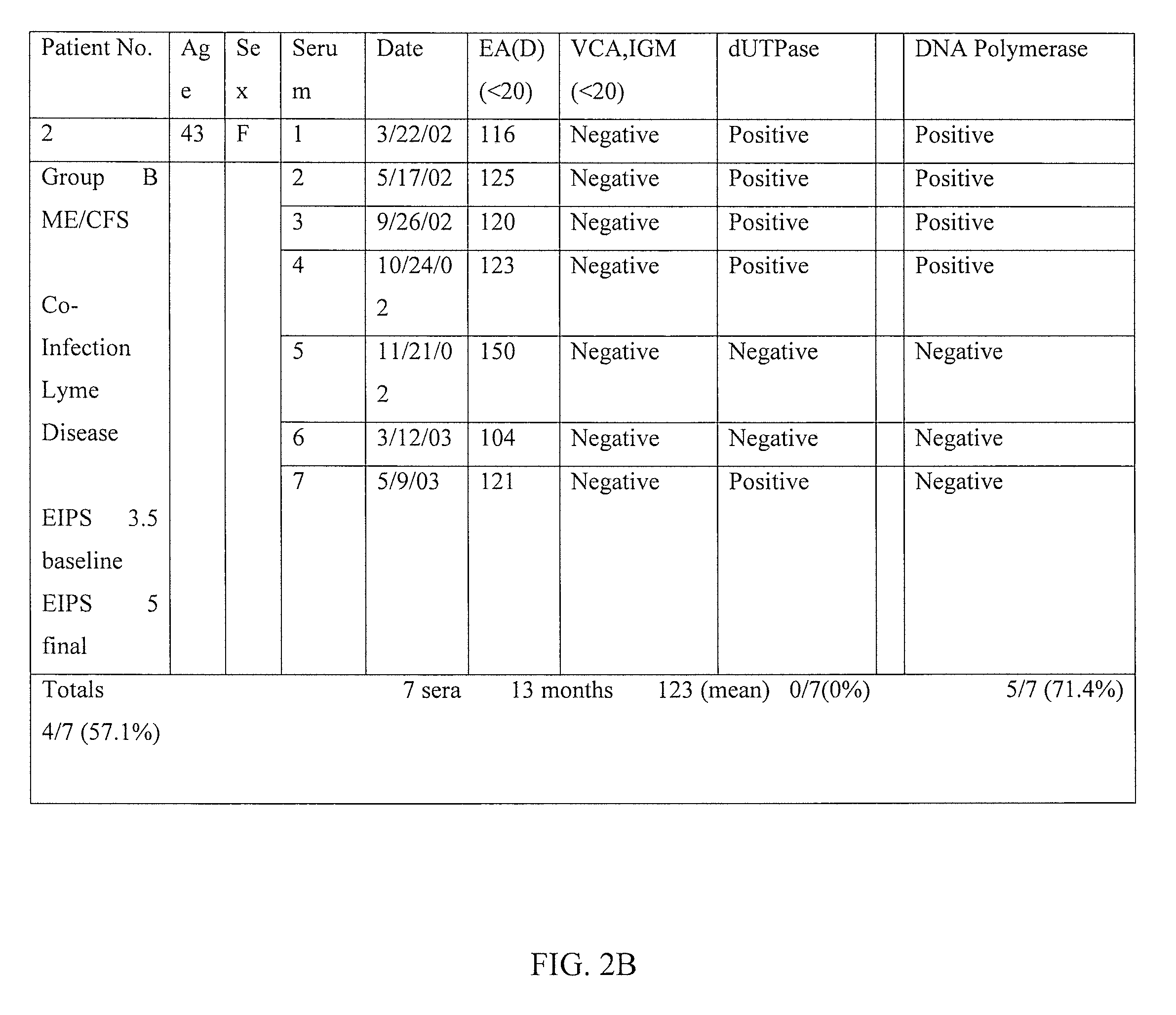 Method of diagnosing and treating epstein barr virus-based myalgic encephalomyelitis chronic fatigue syndrome patients  using a serum antibody assay