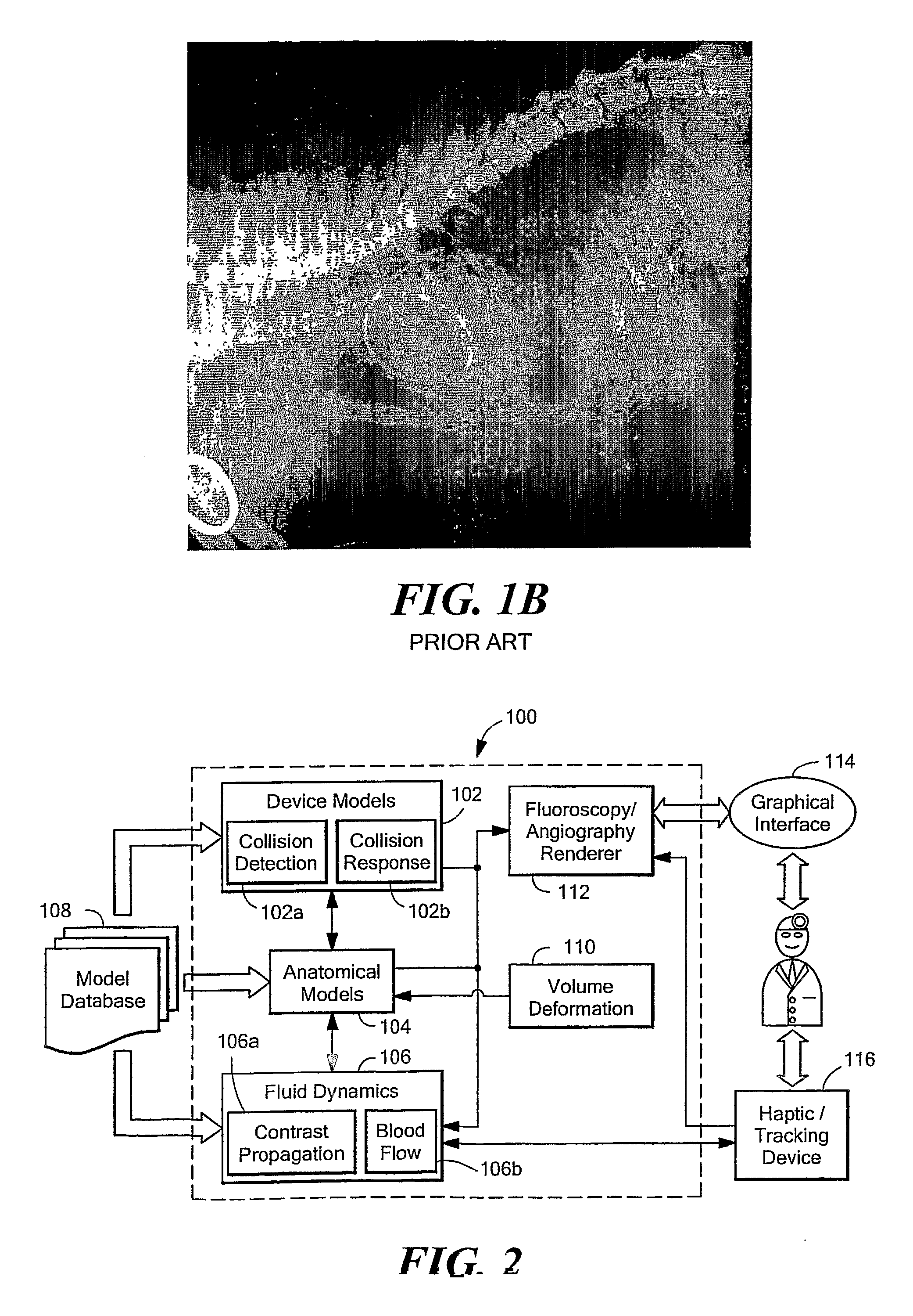 Methods and Apparatus for Simulaton of Endovascular and Endoluminal Procedures