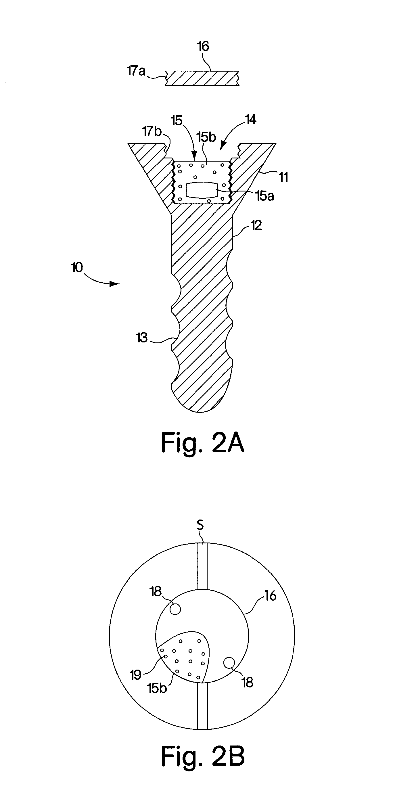 Device and Method for Treating Conditions of a Joint