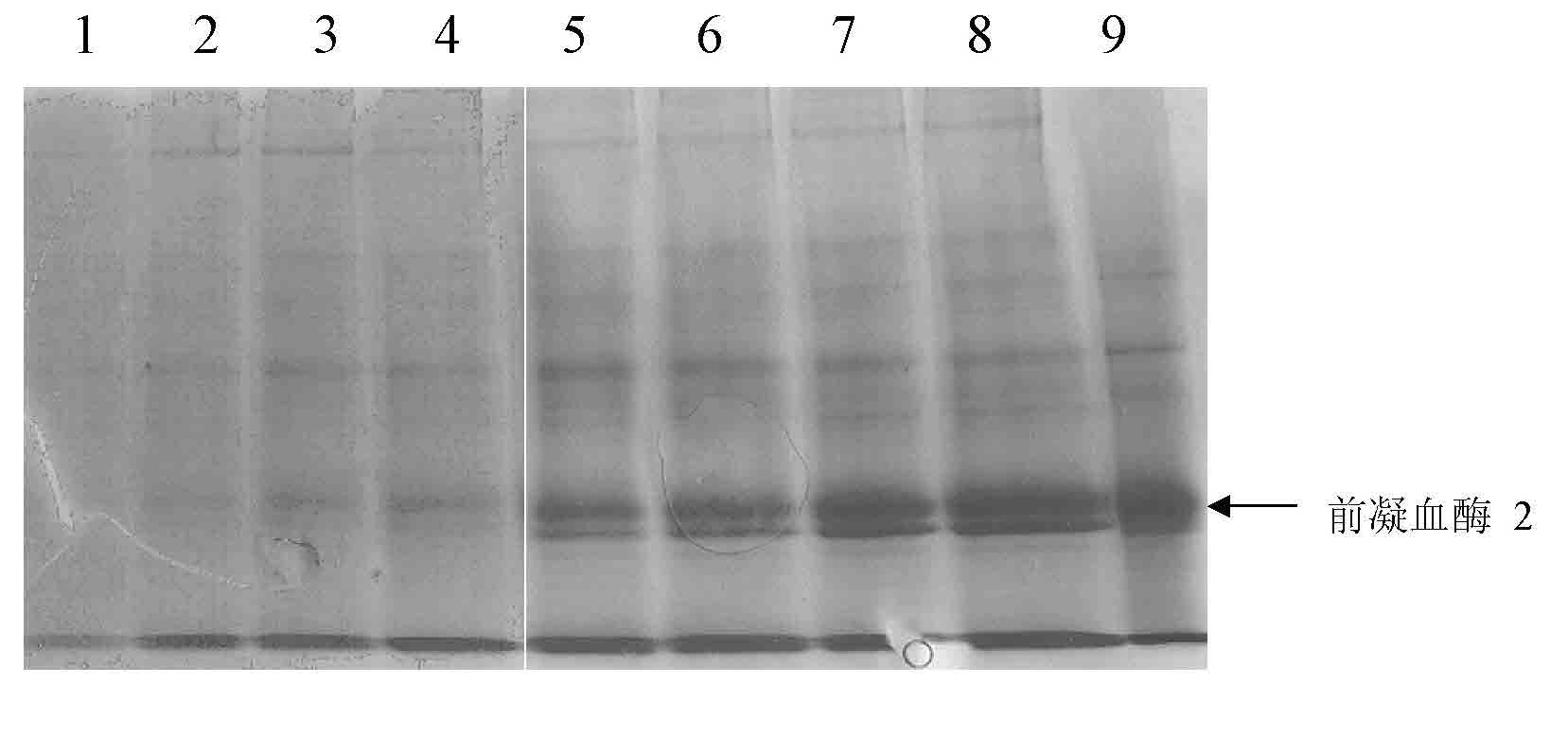 High expression and production method of recombinant human thrombin in animal cell