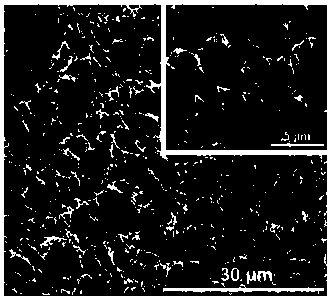 Biomedical degradable double-layer stent for nerve repair and preparation method thereof