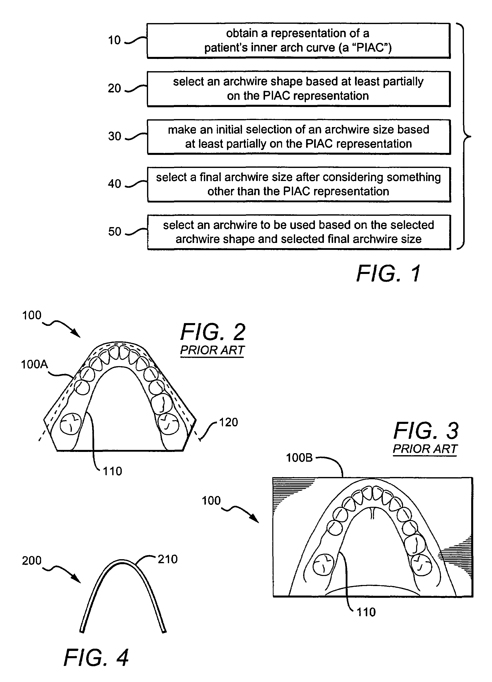 System for automatic selection of an archwire