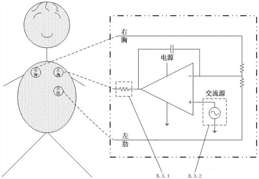 Wireless, portable and wearable electrocardiogram detector capable of restraining motion interference