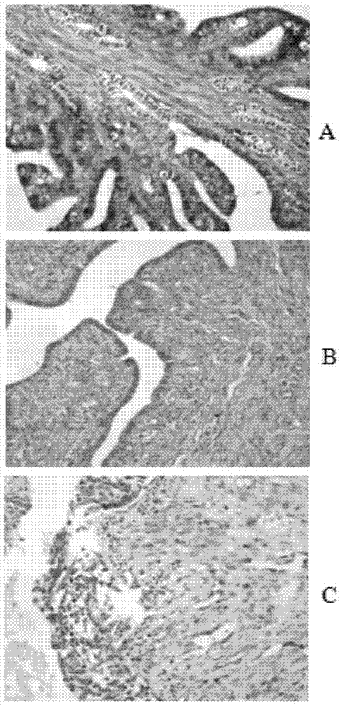 Chitosan-salvia miltiorrhiza injection and preparation method thereof