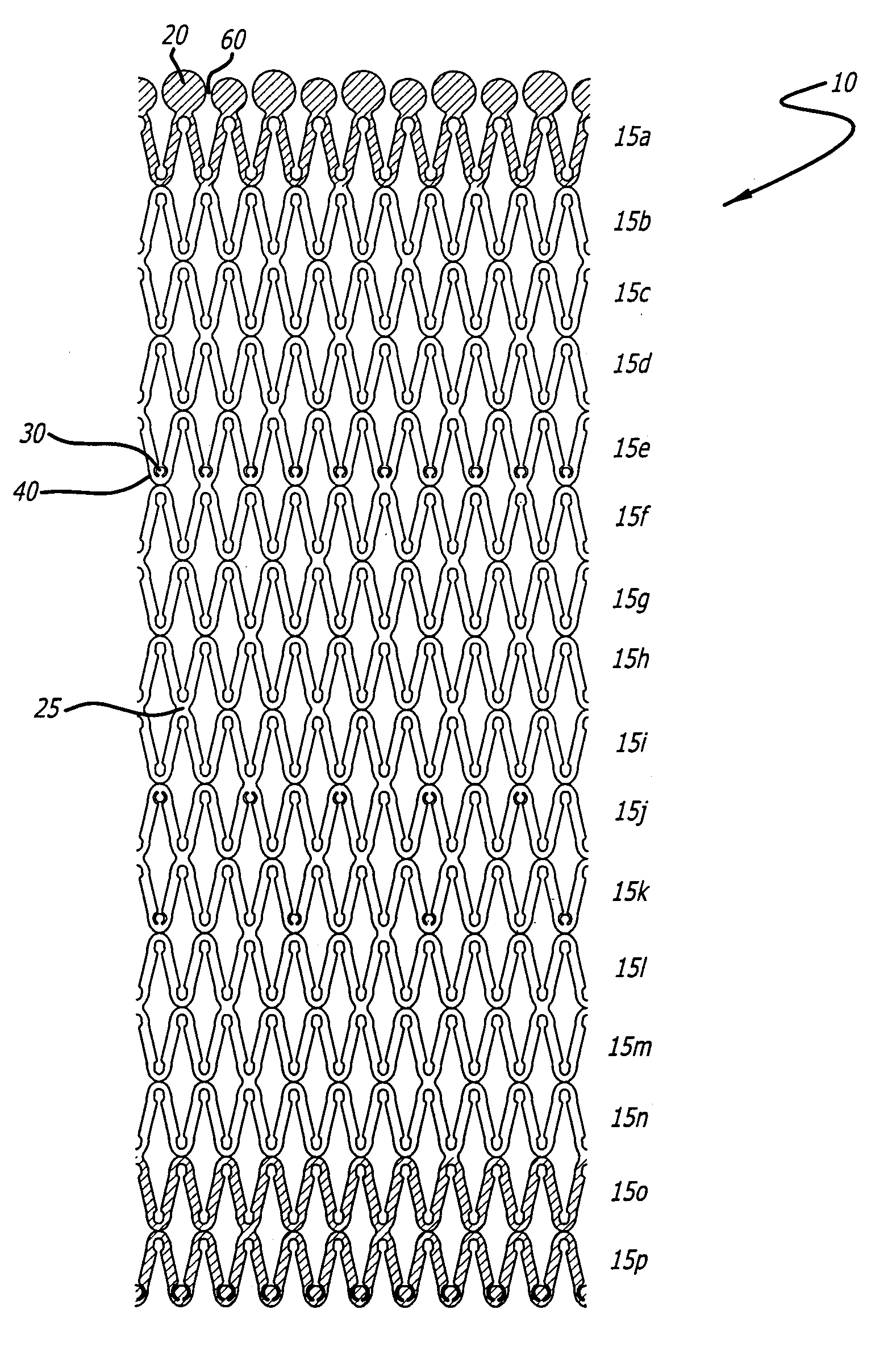 Implantable Stent with Degradable Portions