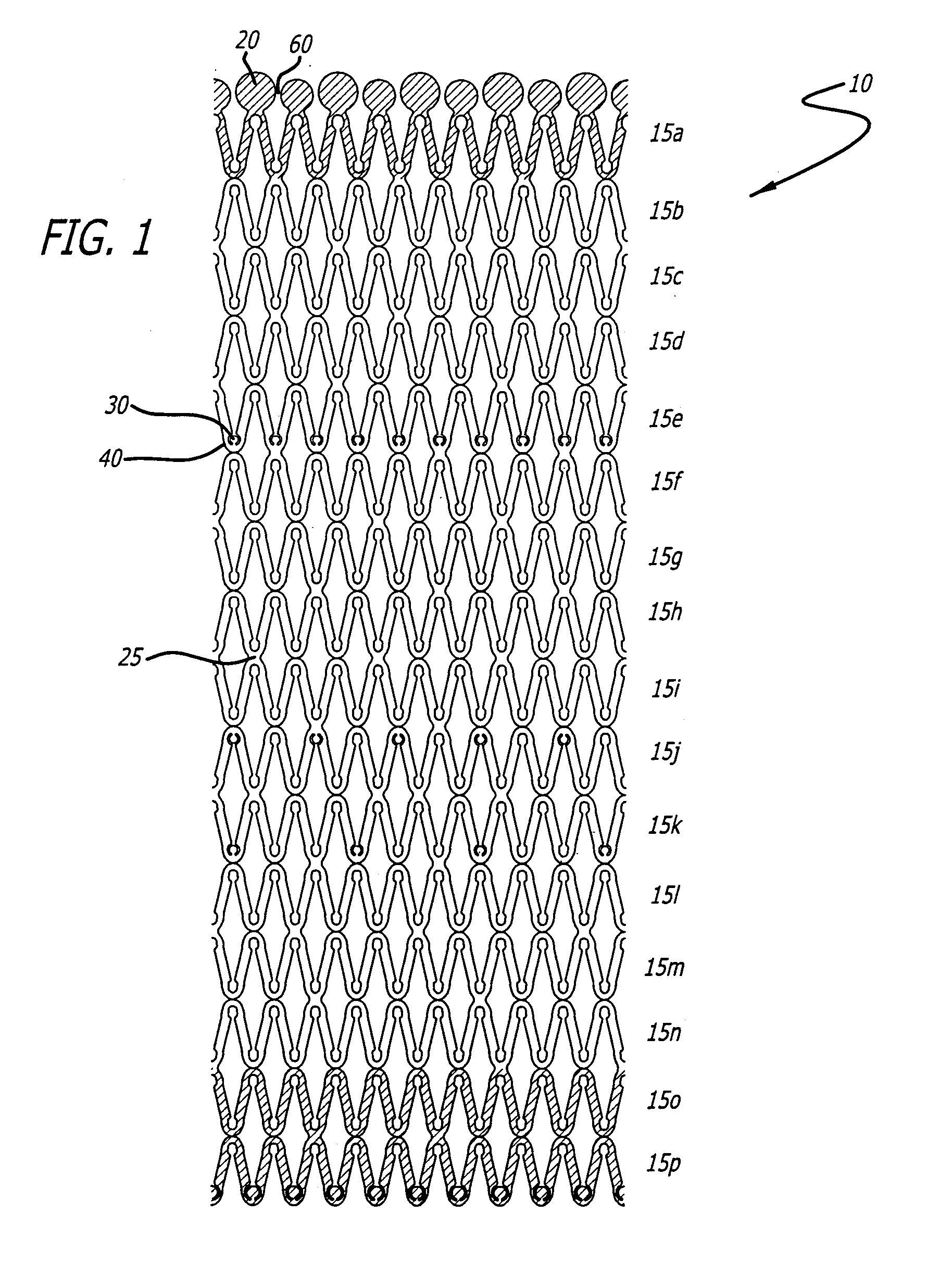 Implantable Stent with Degradable Portions