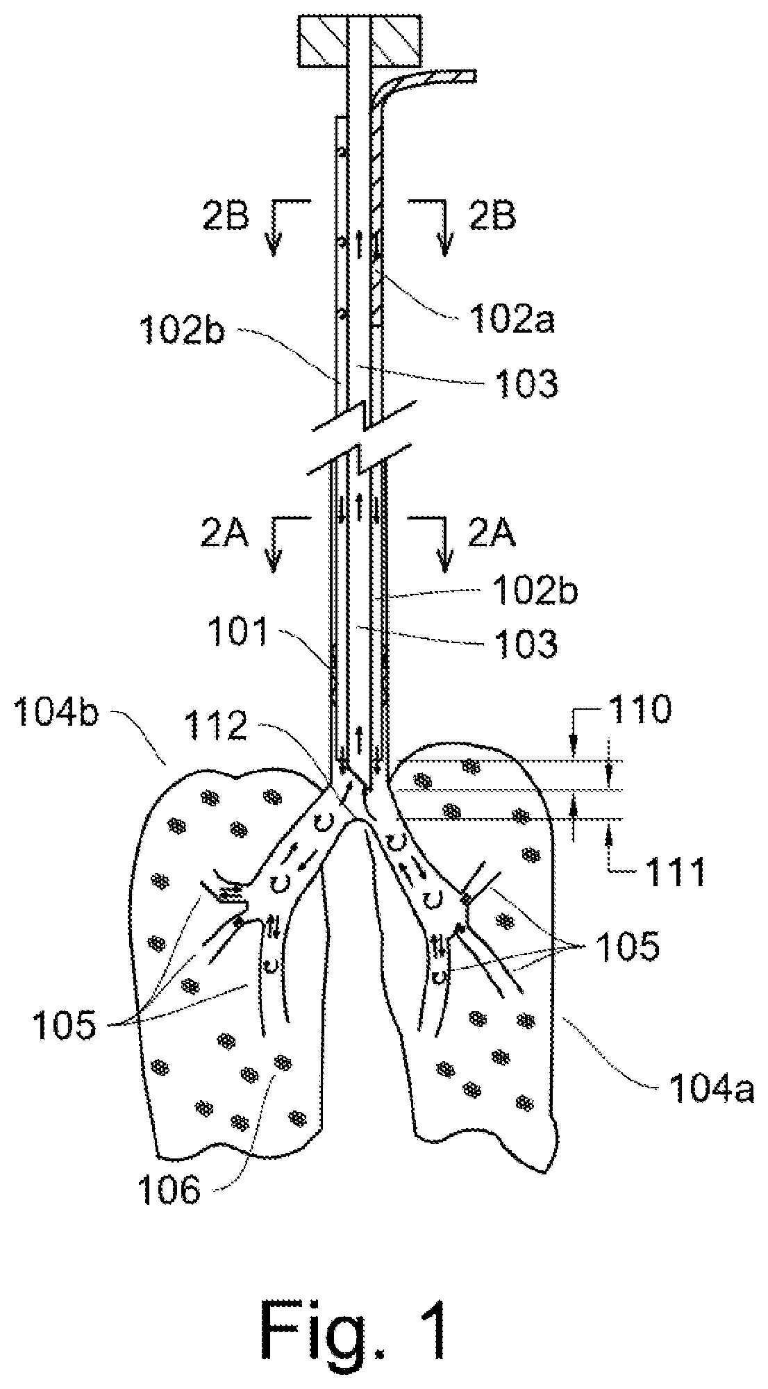 Patient Ventilator Control Using Constant Flow and Breathing Triggers