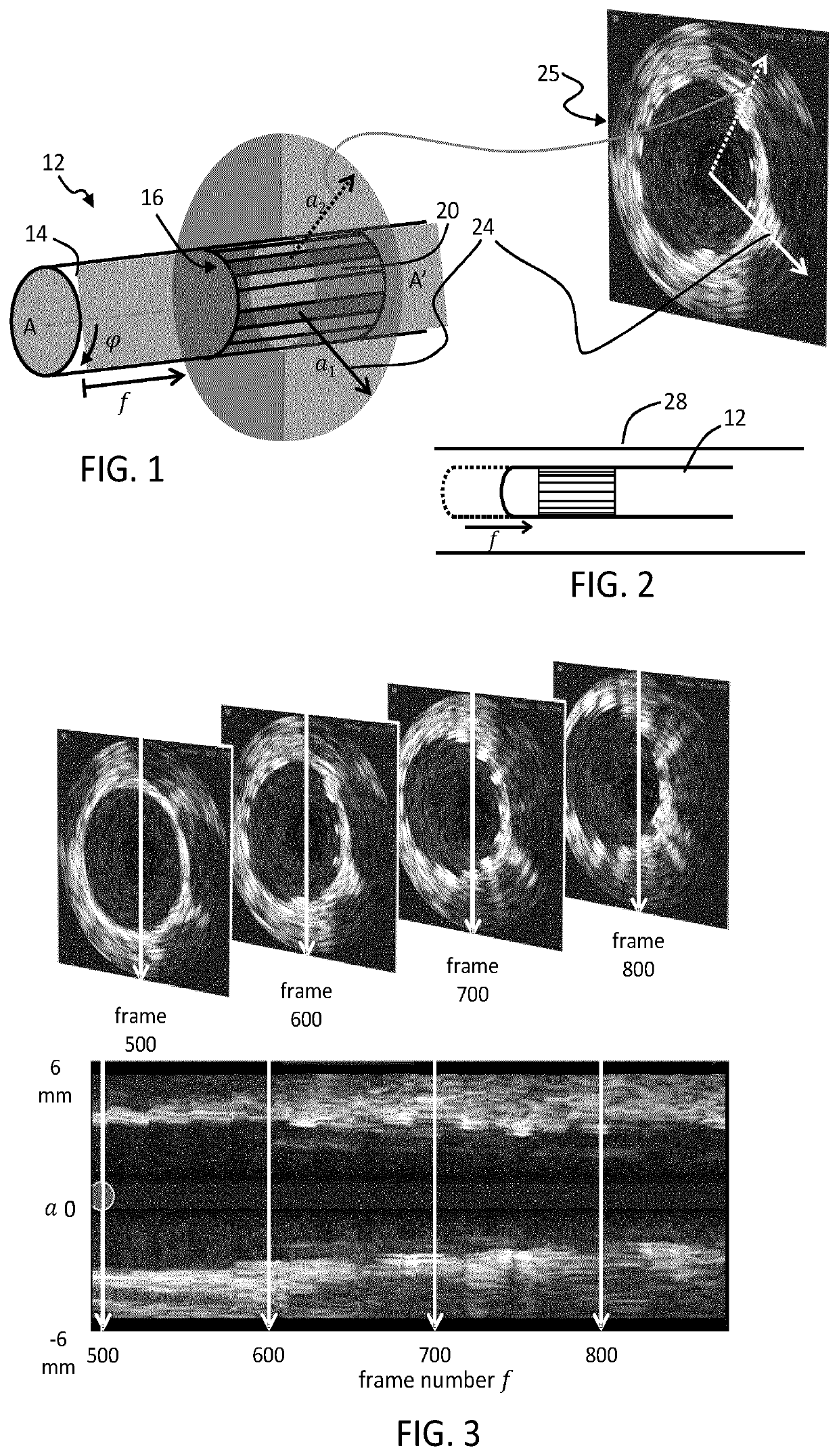 Ultrasound analysis method and device