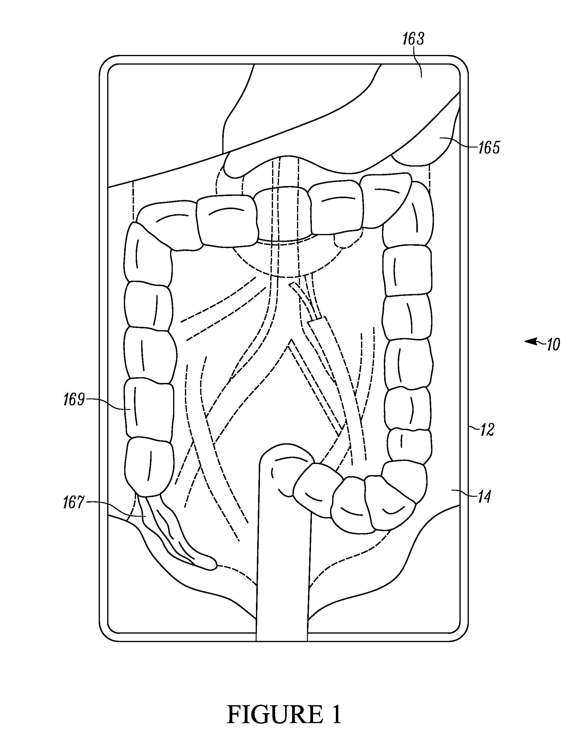 Surgical training aid apparatus