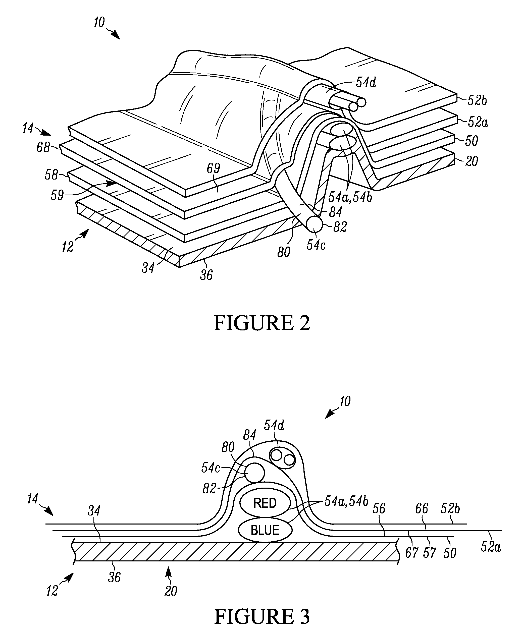 Surgical training aid apparatus