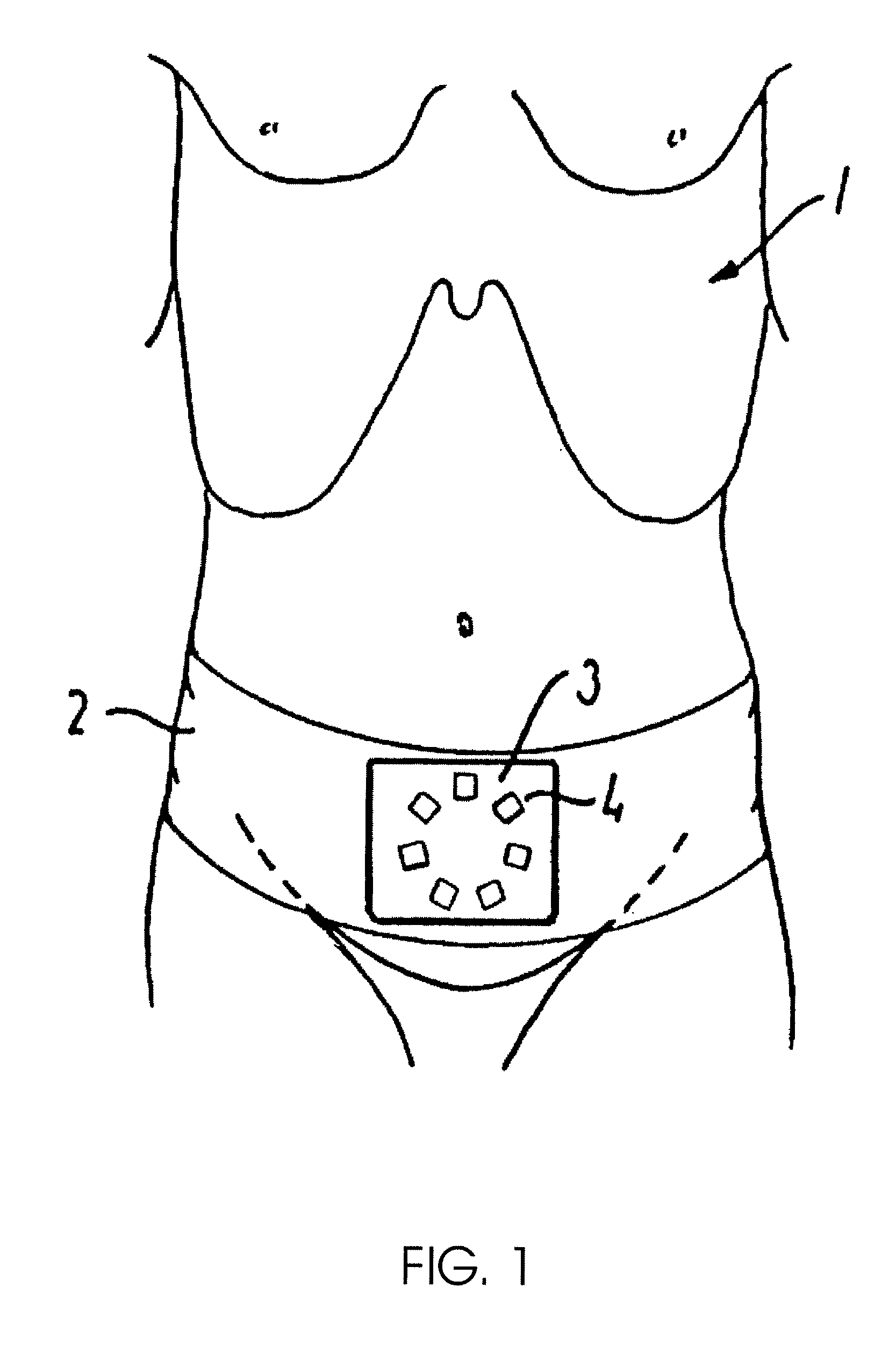 Method and an apparatus for recording bladder volume