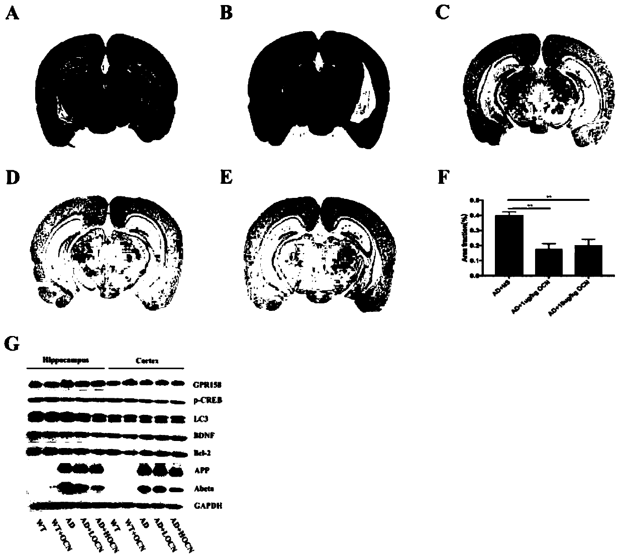 Application of osteocalcin to preparation of medicines for Alzheimer's disease